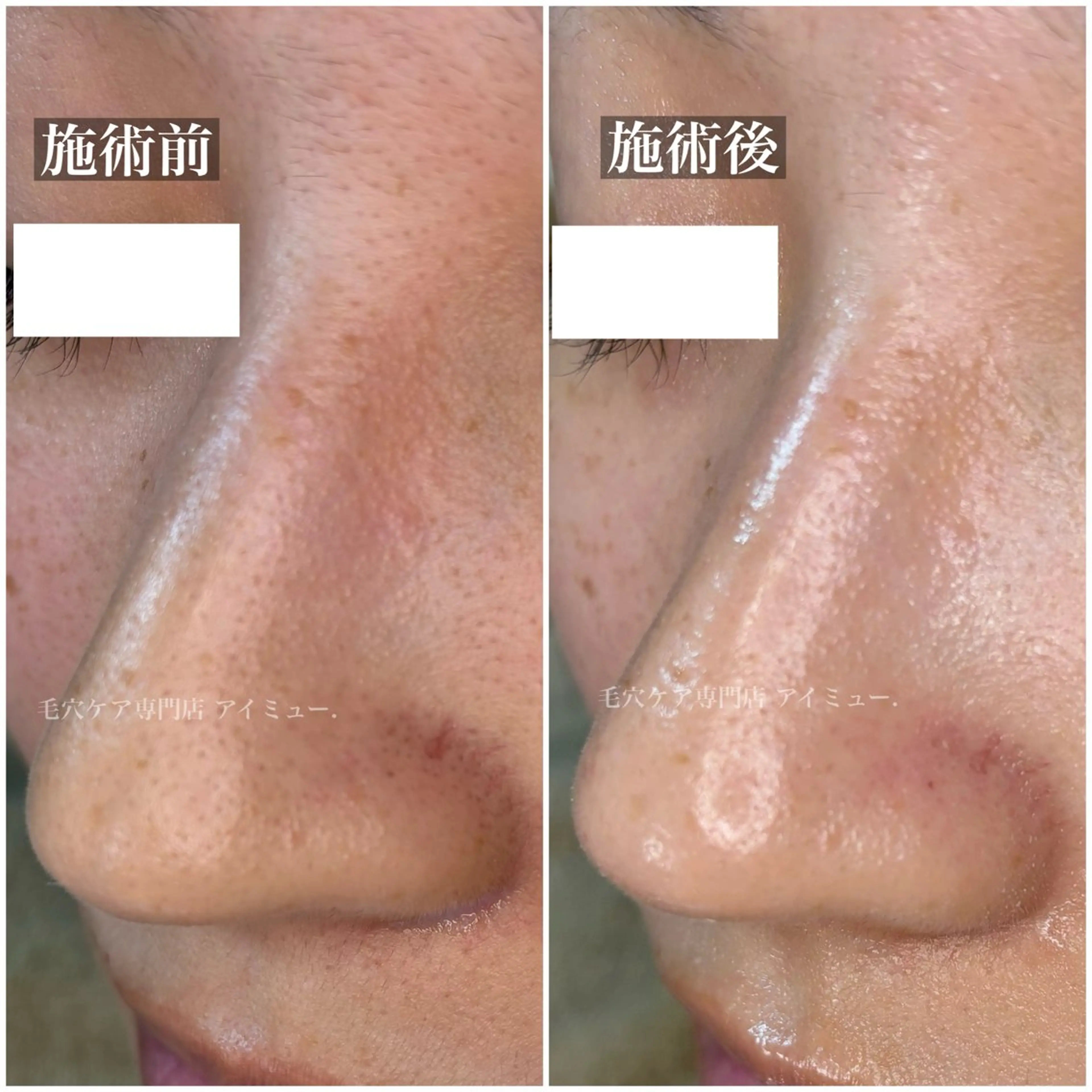 毛穴専門店アイミュー mamiのエステ・リラクイメージ