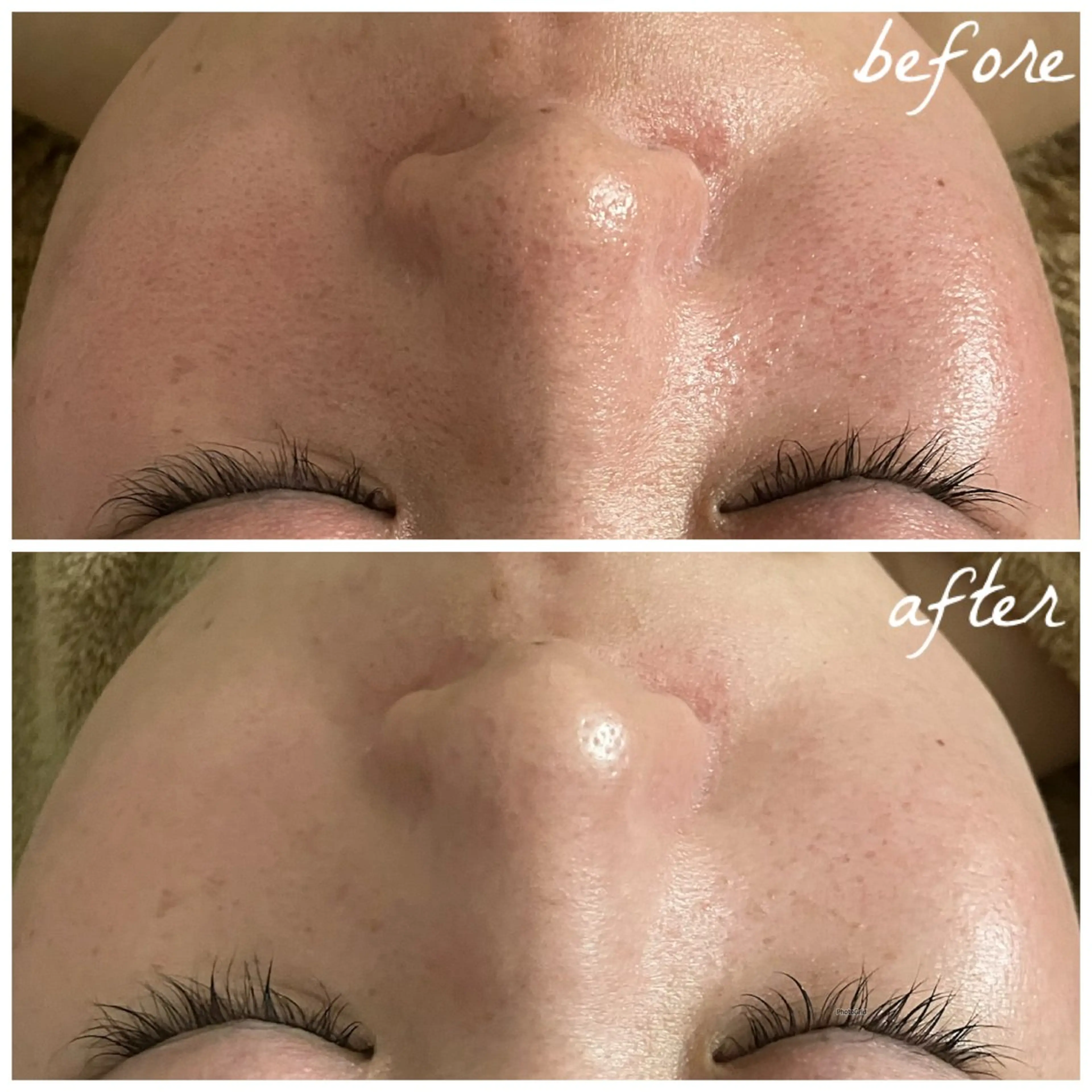 メンズ エステ メナード岐阜市茜部 杉浦のエステ・リラクイメージ