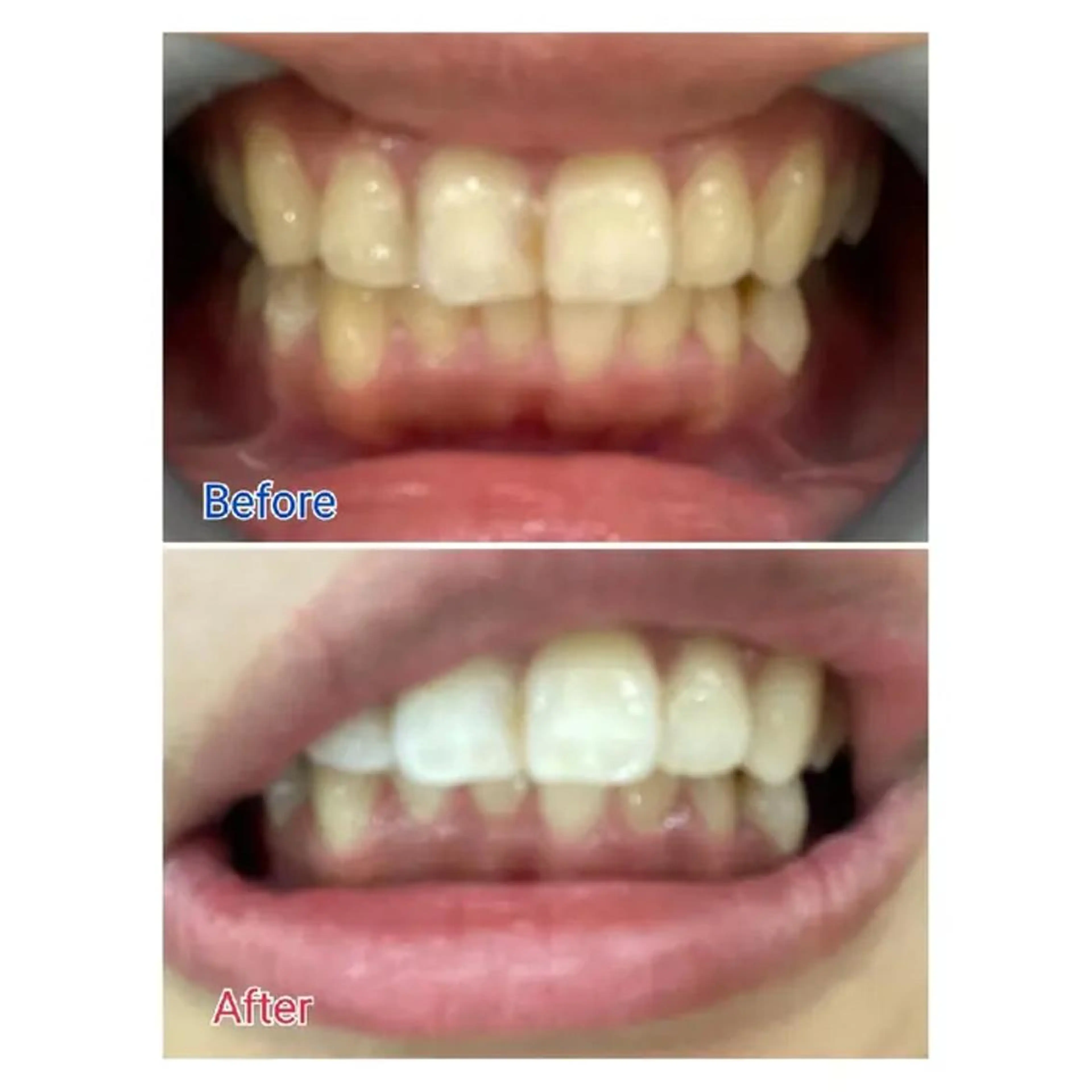 M渋谷店所属・Ｍ渋谷 ホワイトニングのその他イメージ