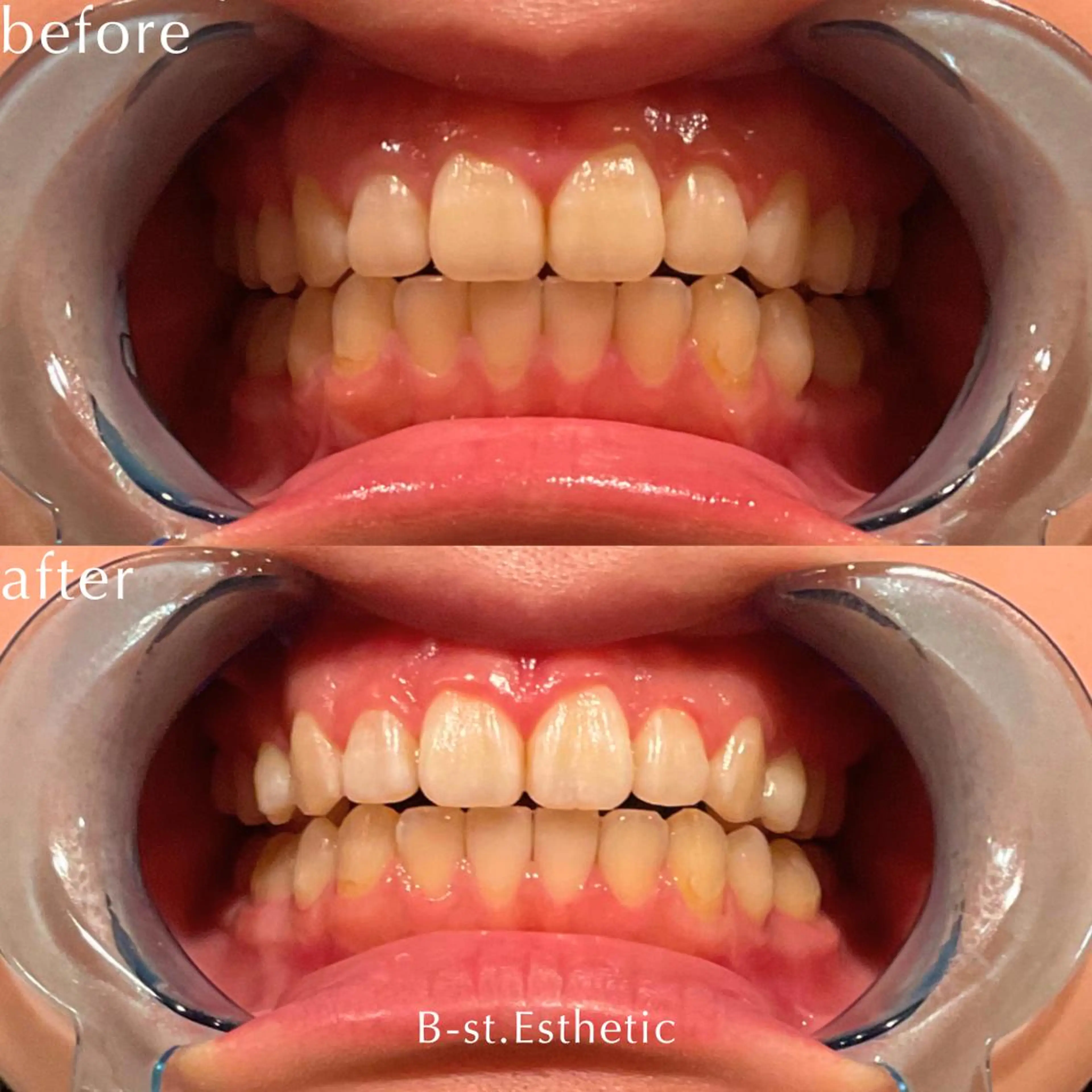 その他 B-st. 下北沢のその他イメージ