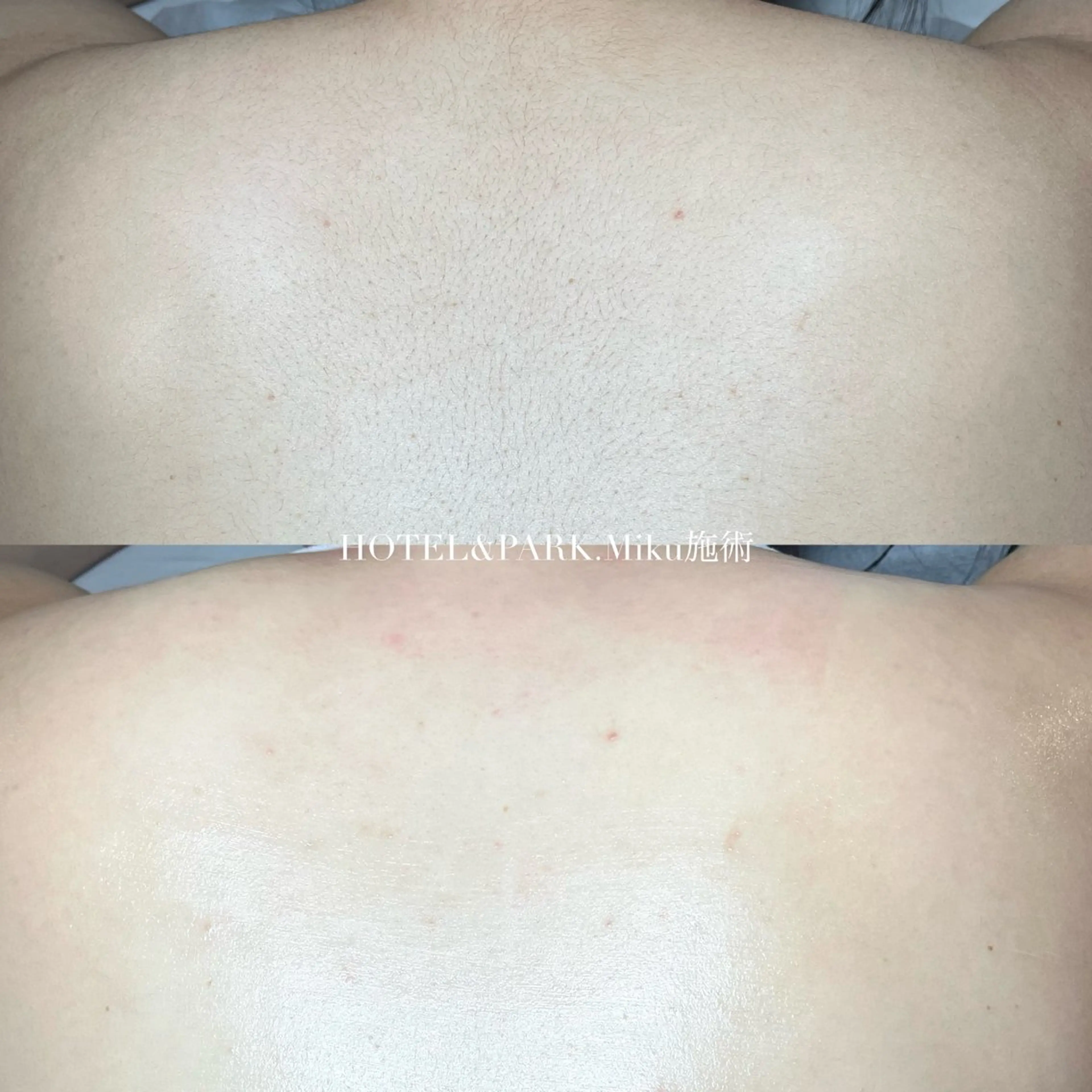 HOTEL&PARK Mikuワックス脱毛のエステ・リラクイメージ