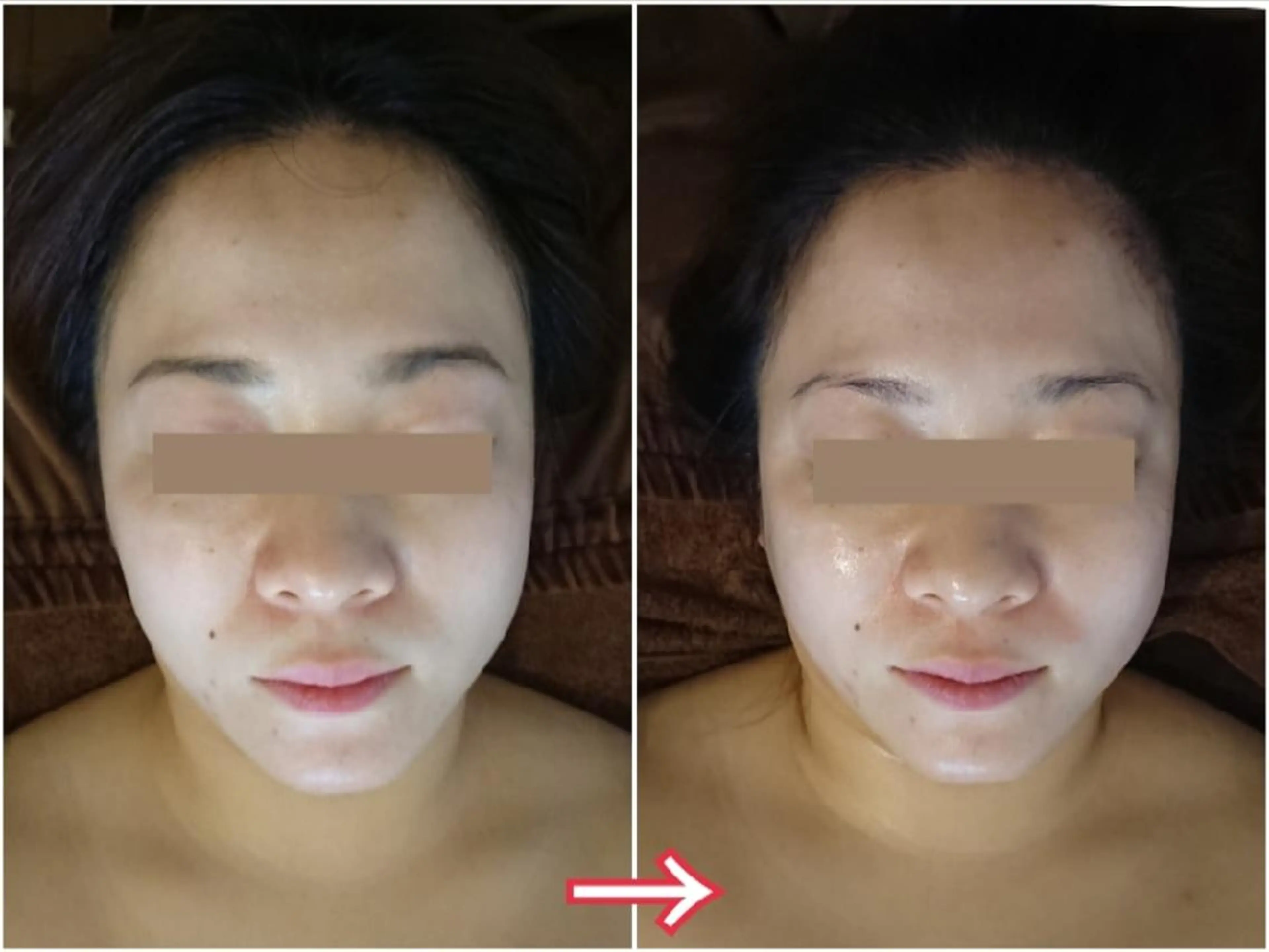 Jeliss~美爪育成ネイル＆頭蓋骨小顔矯正サロン~所属・美顔(小顔)矯正& 美爪育成Jelissのエステ・リラクイメージ