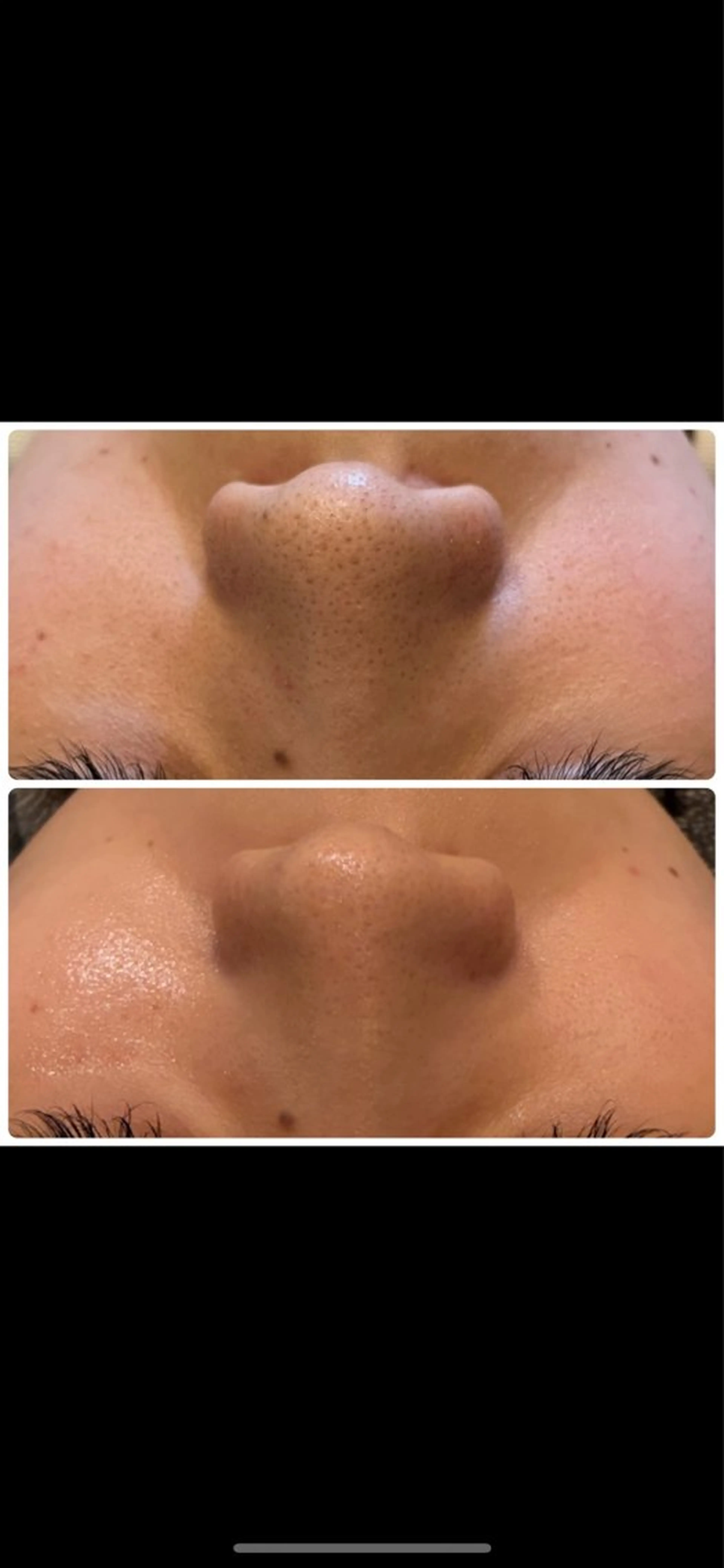 エステ yellow.所属・yellow💛【 脱毛&フェイシャル】のエステ・リラクイメージ