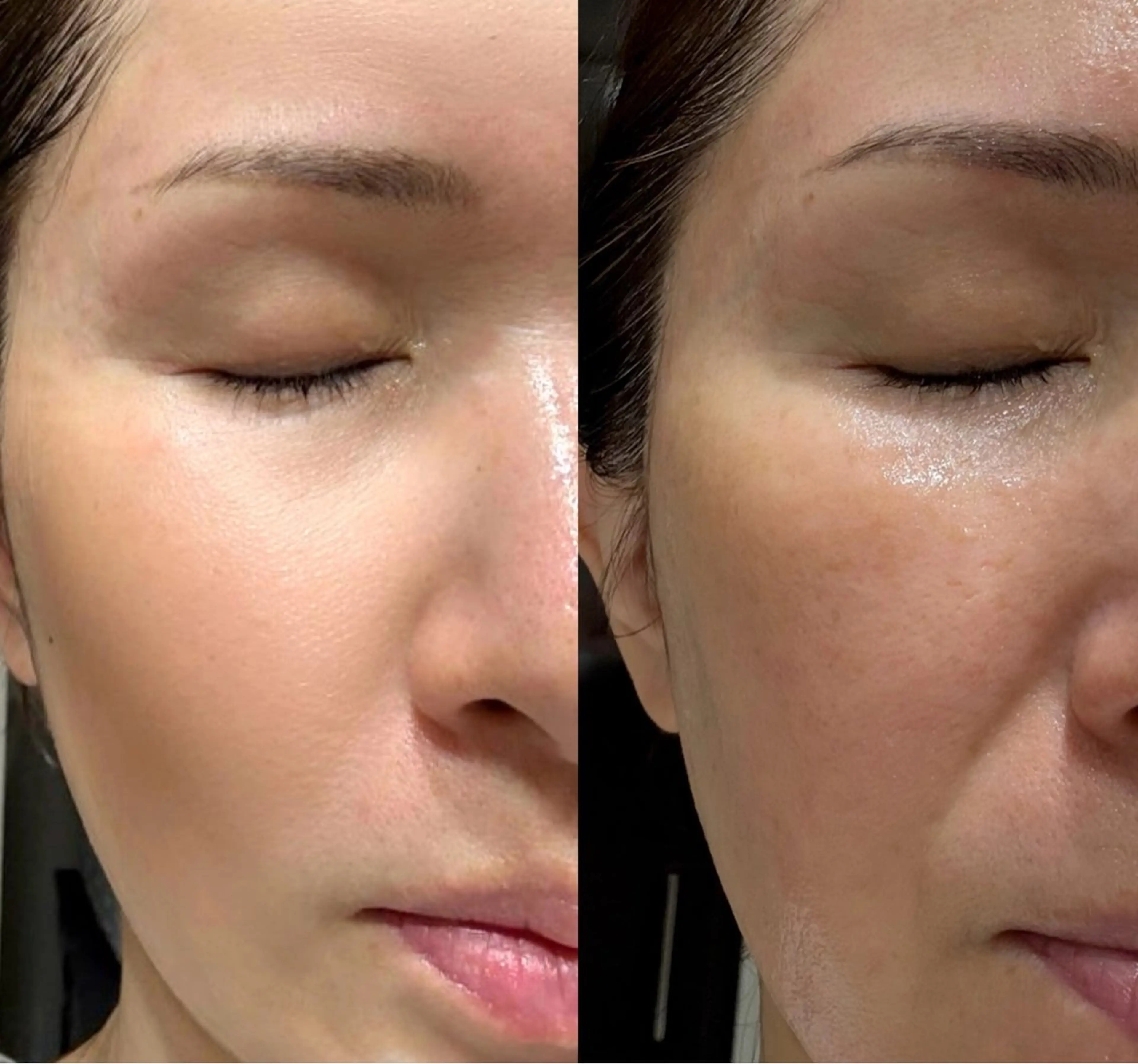 エステ mire（ミレ） トータルビューティーのエステ・リラクイメージ