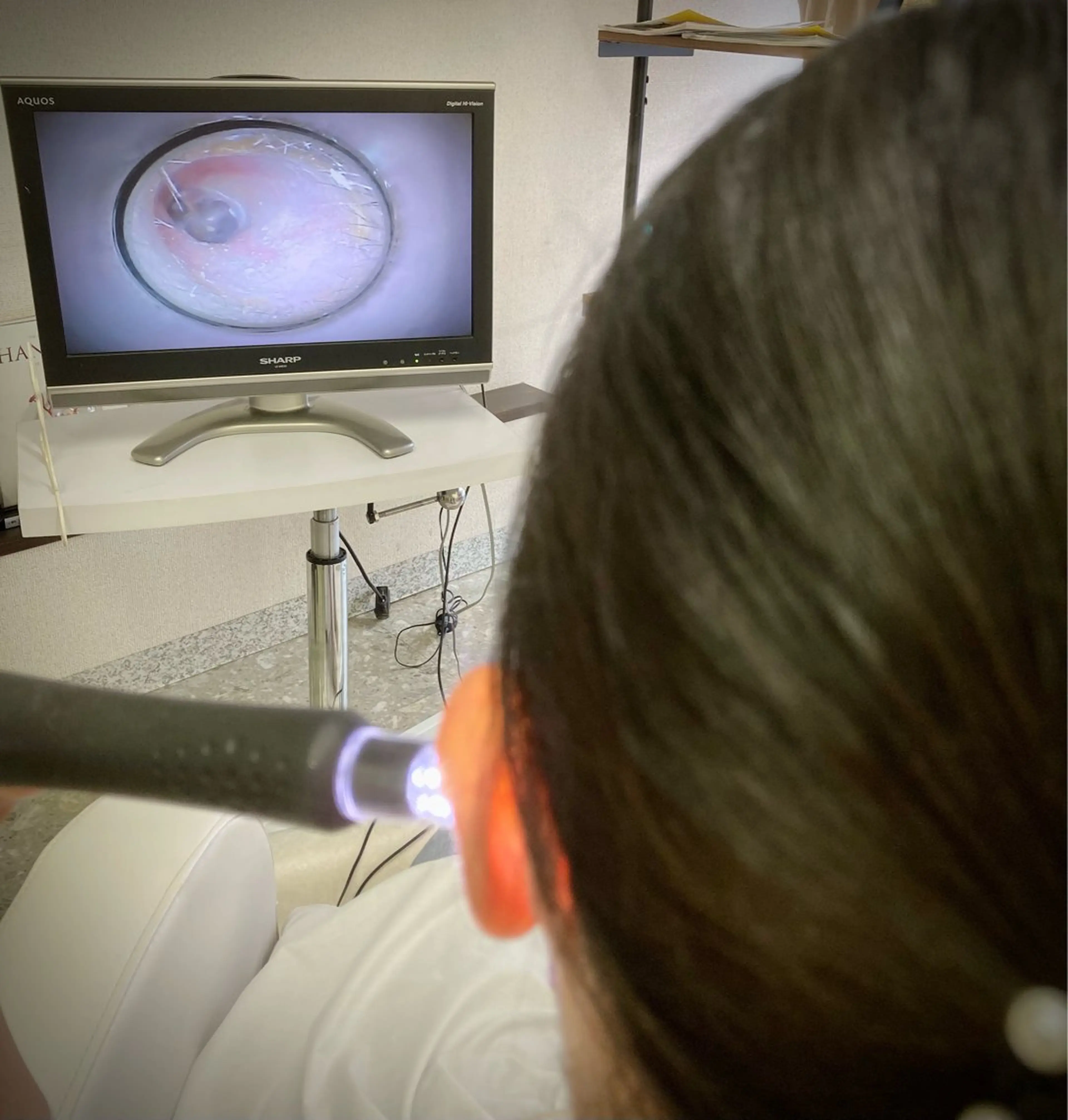 【モニター価格】見える耳そうじ40分+ドライヘッドスパ20分+耳オイル10分の写真