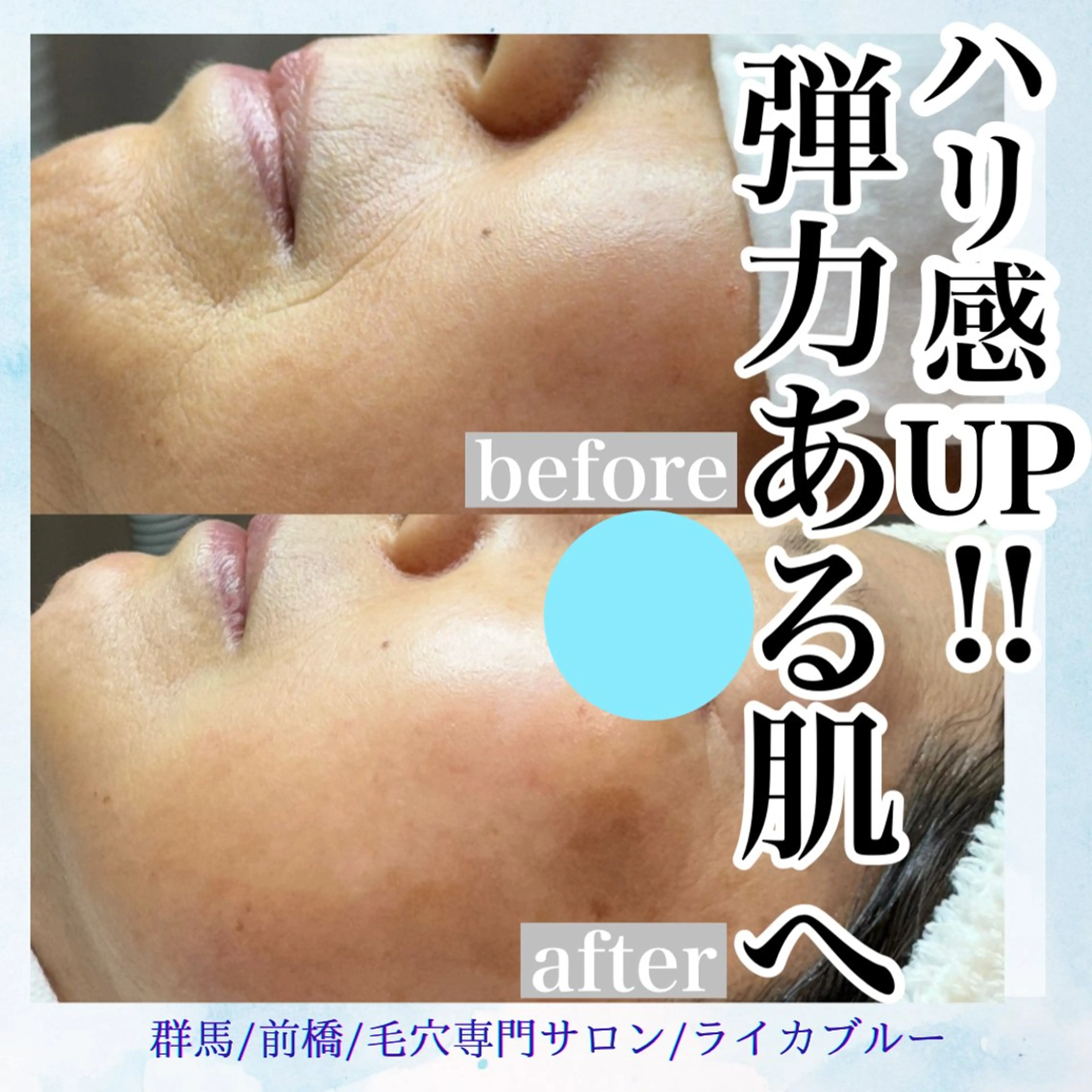 毛穴専門サロン ライカブルーのエステ・リラクイメージ