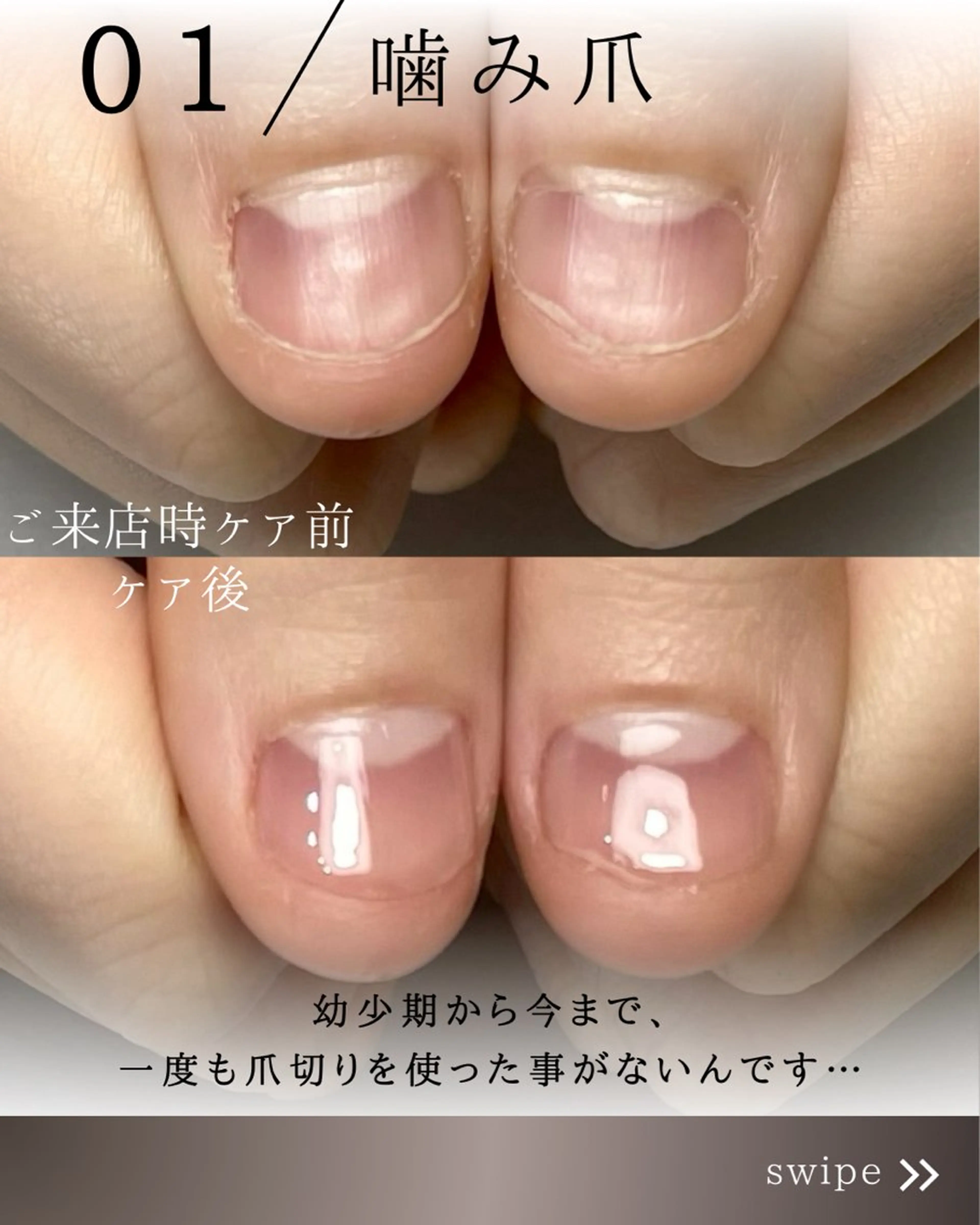 ネイル ジェルネイル Aim* 深爪・自爪育成専門店のネイルデザイン