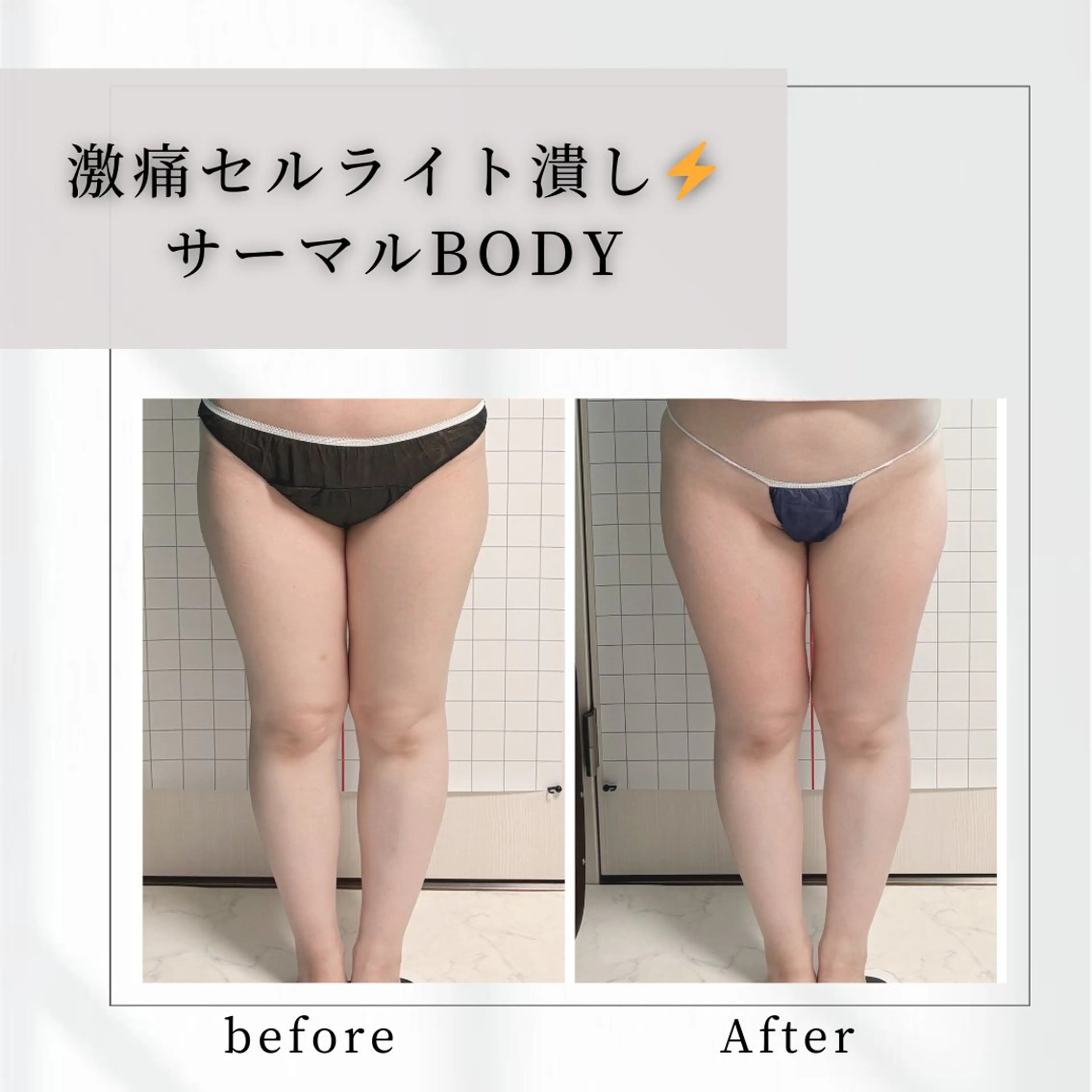 小顔矯正専門店 【RED】池田のエステ・リラクイメージ