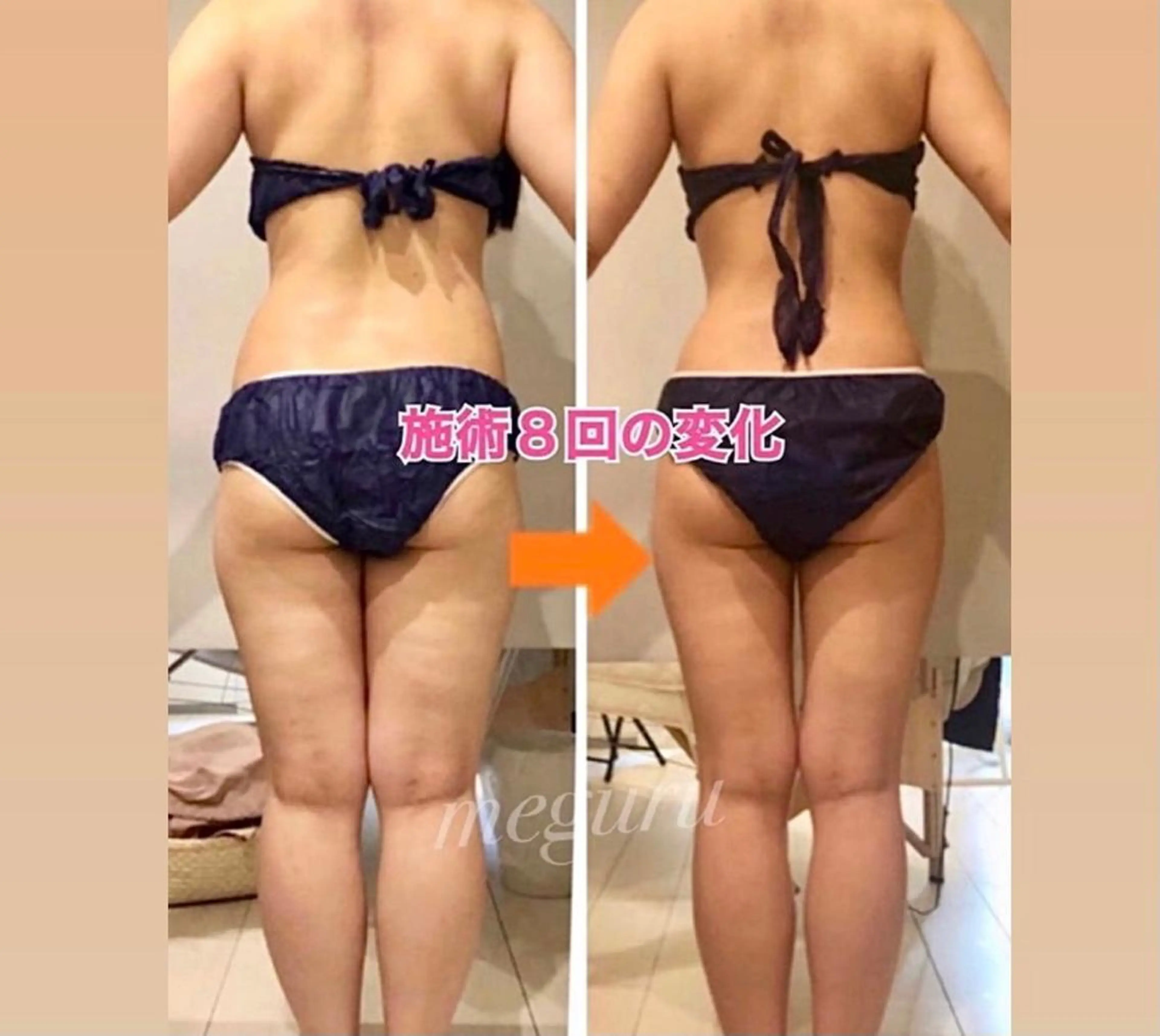 ショート カラー パーマ ヘアアレンジ メンズ キッズ ネイル マツエク・マツパ エステ リラク ‍痩身＆ボディ 結果出し🌟丹野のエステ・リラクイメージ