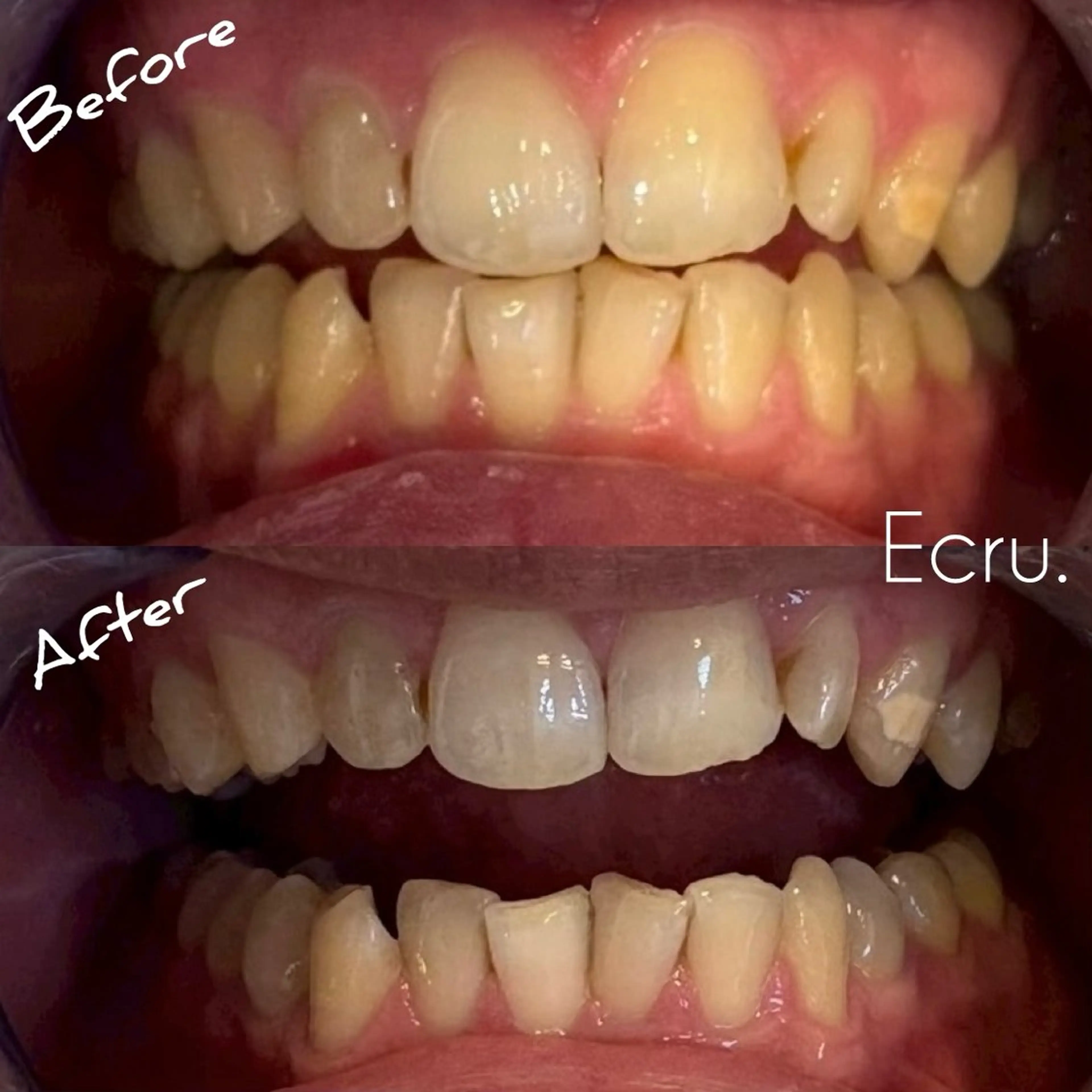 メンズ キッズ その他 ホワイトニングサロン Ecru所属・ホワイトニングサロン Ecru エクリュのその他イメージ