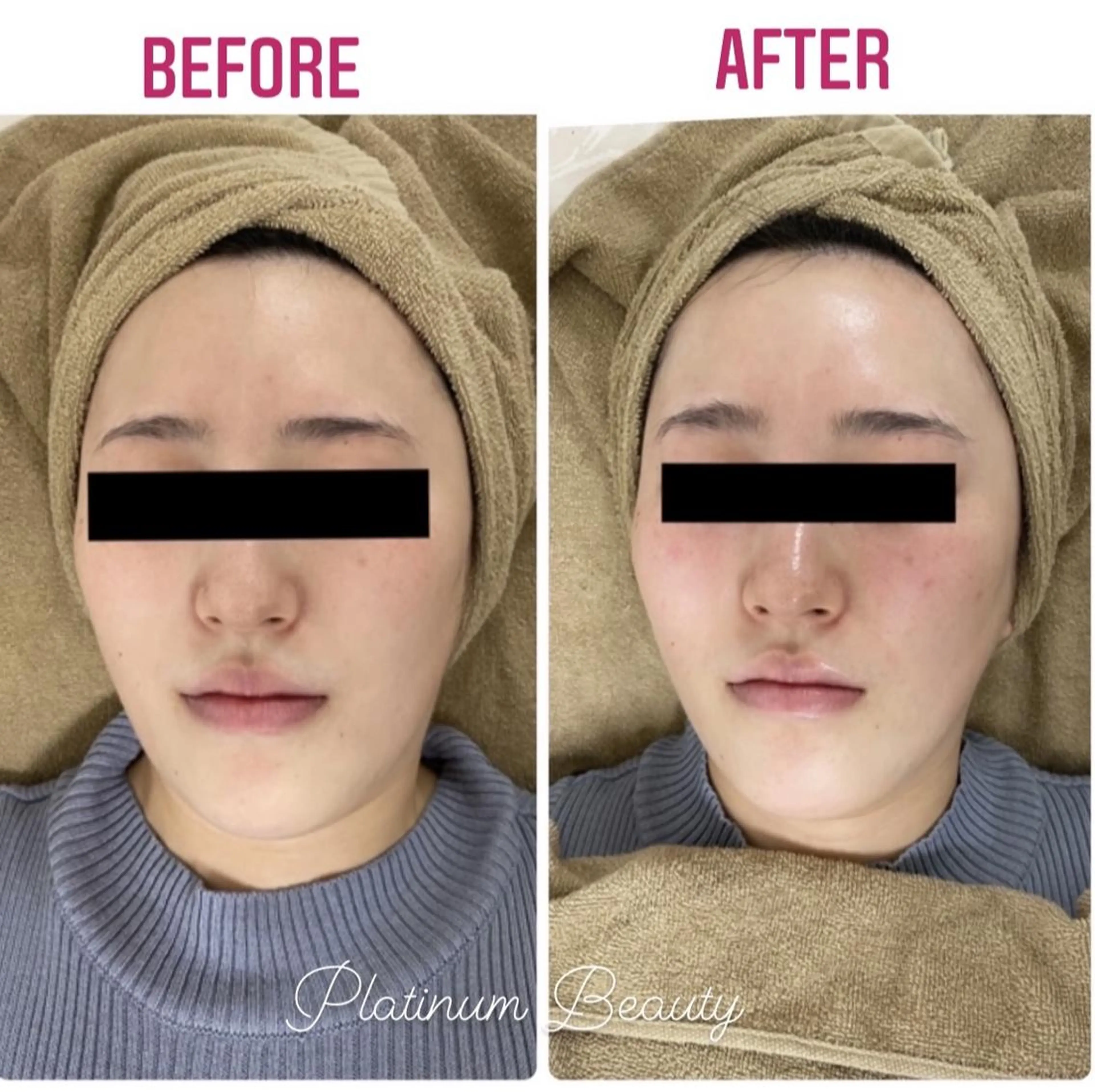 プラティーヌ ボーテのその他イメージ