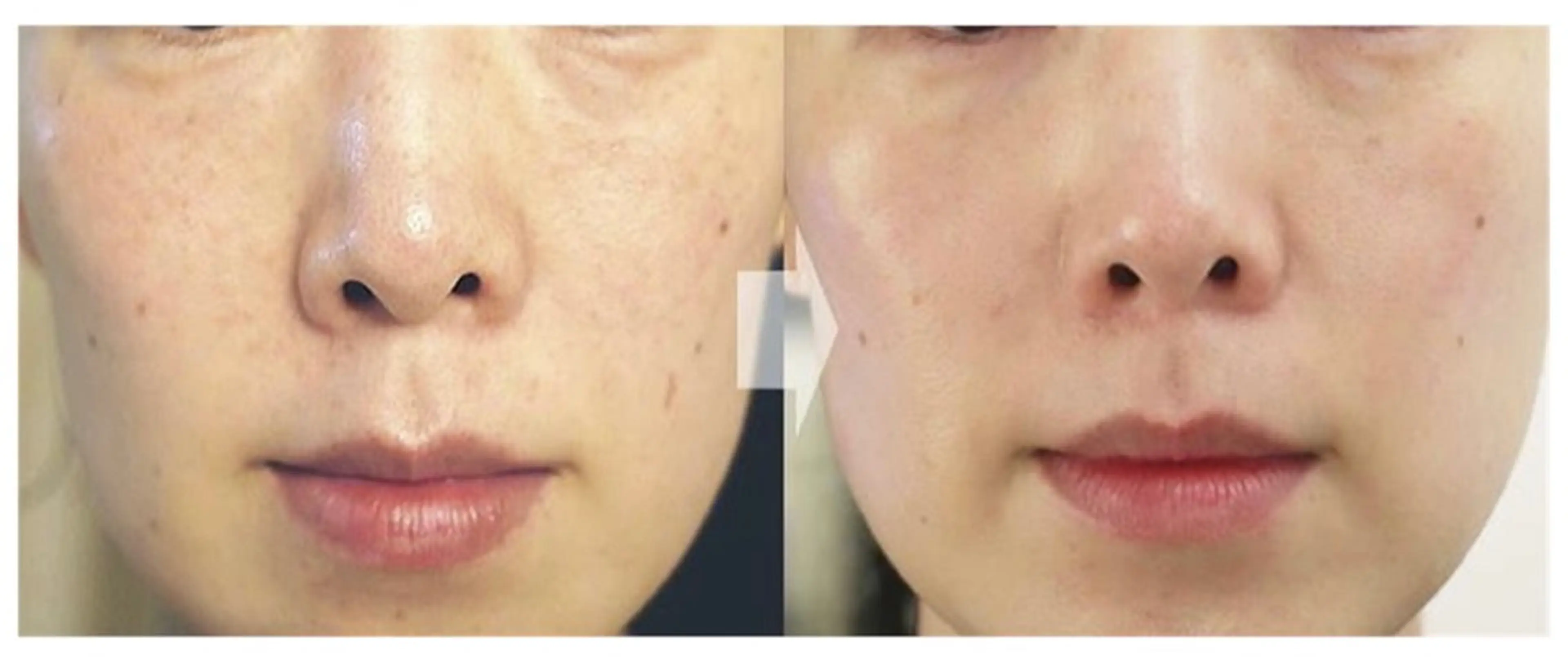 エステ LiZA エステティックサロンのその他イメージ