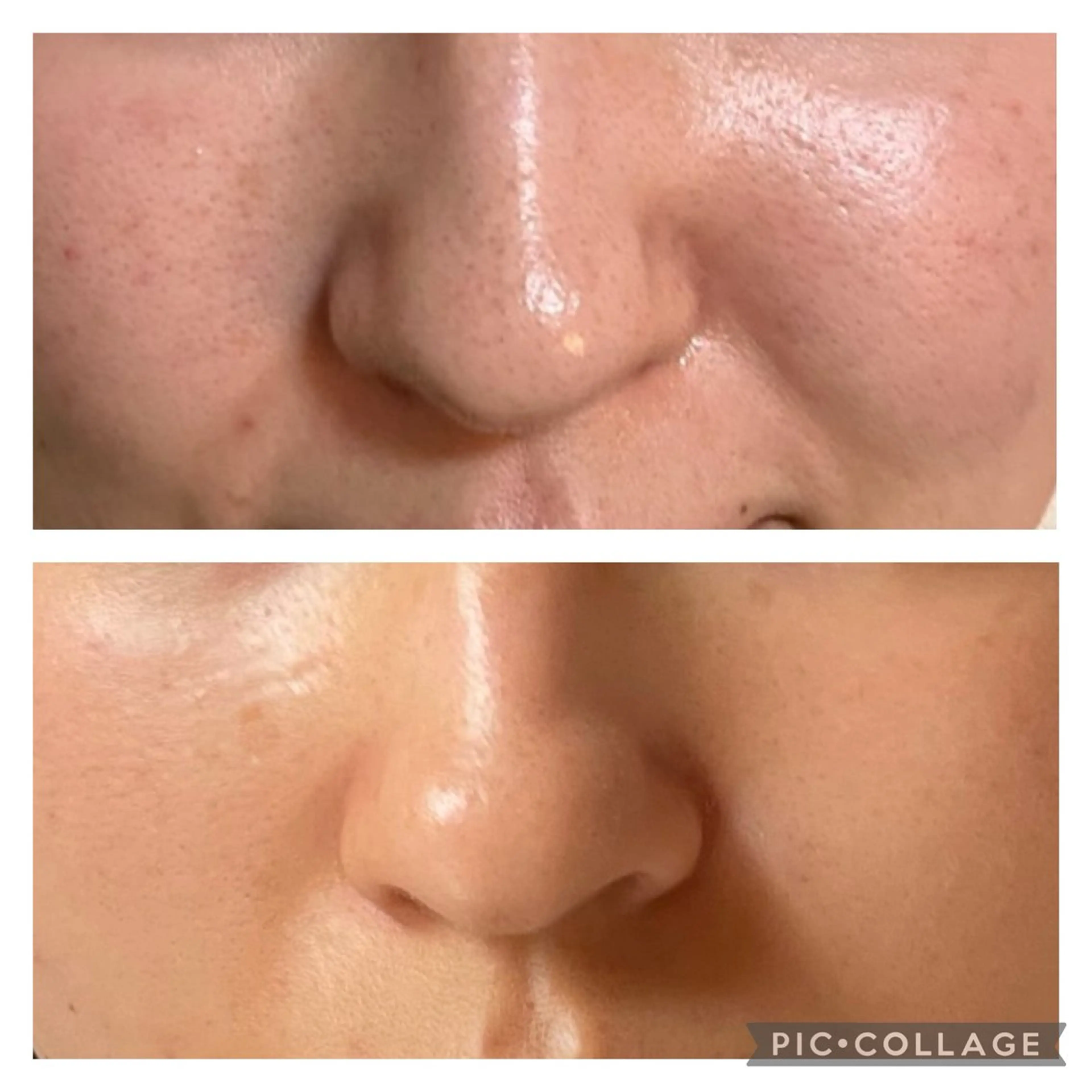 肌質改善🕊️ hirokoのエステ・リラクイメージ