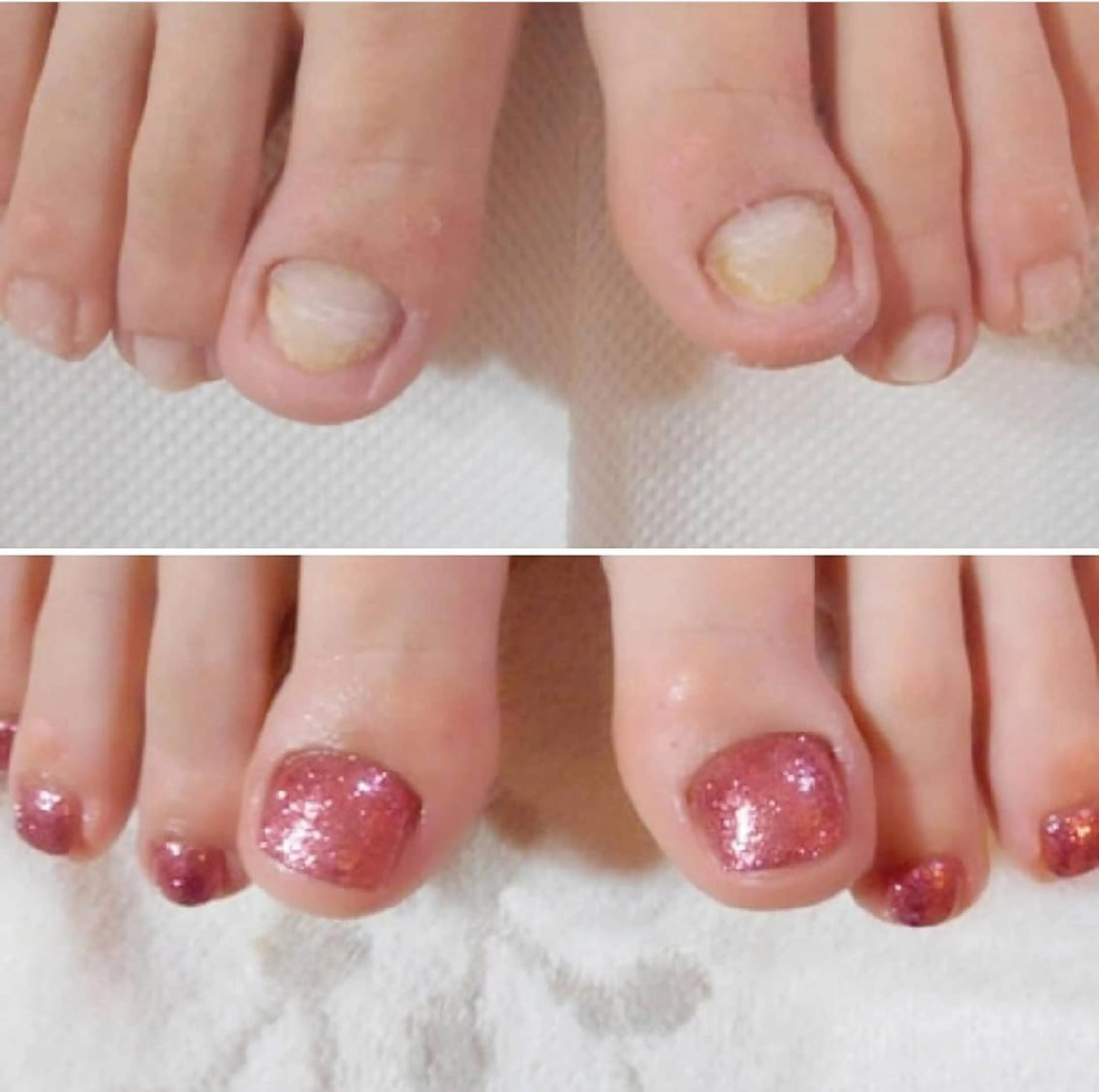 ネイル フットネイル ネイルサロンアリューム所属・ネイルサロン アリュームのネイルデザイン