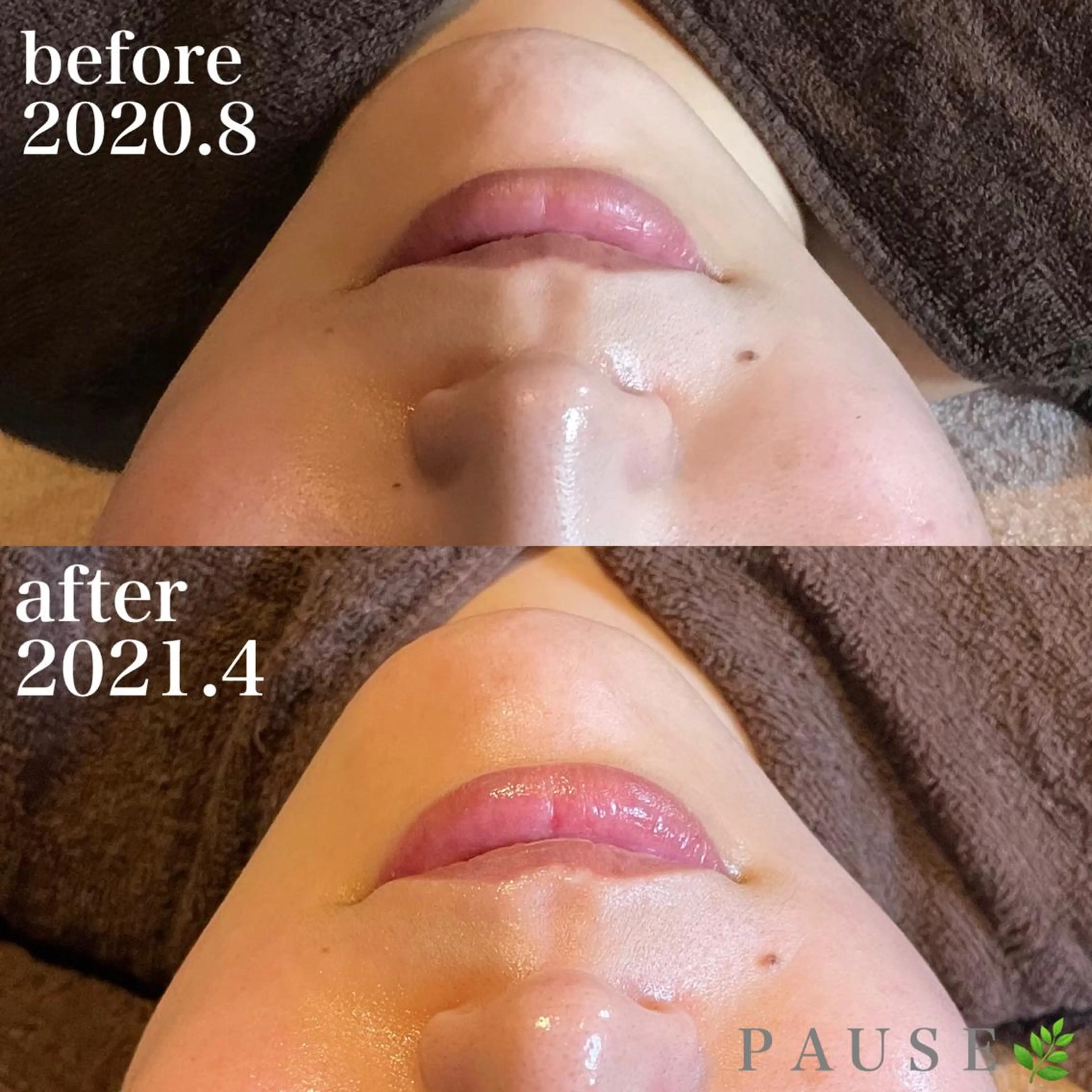 エステ 浜野 恵美のエステ・リラクイメージ