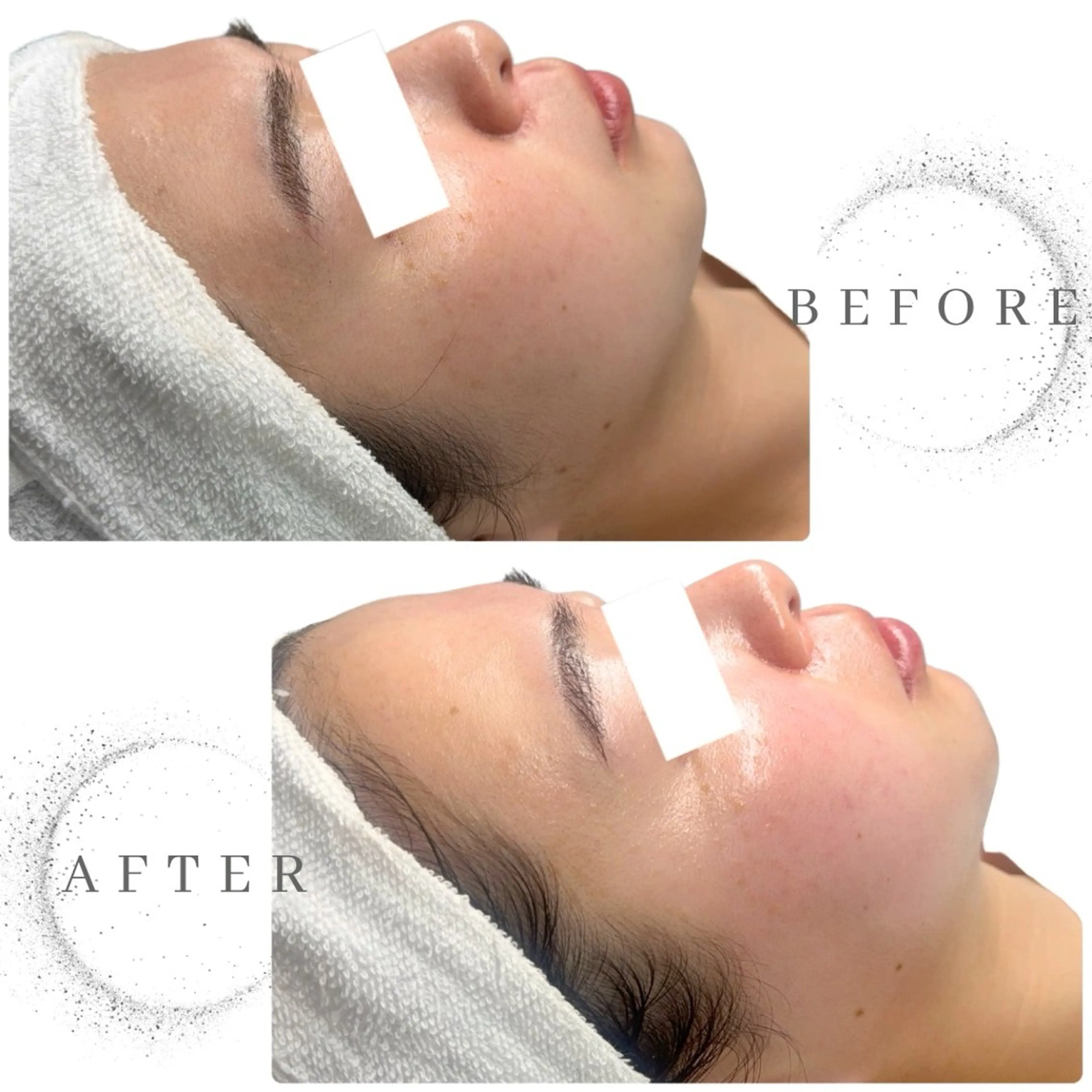 ✨️艶肌フェイスワックス✨️何回でも同じ料金‼️の写真