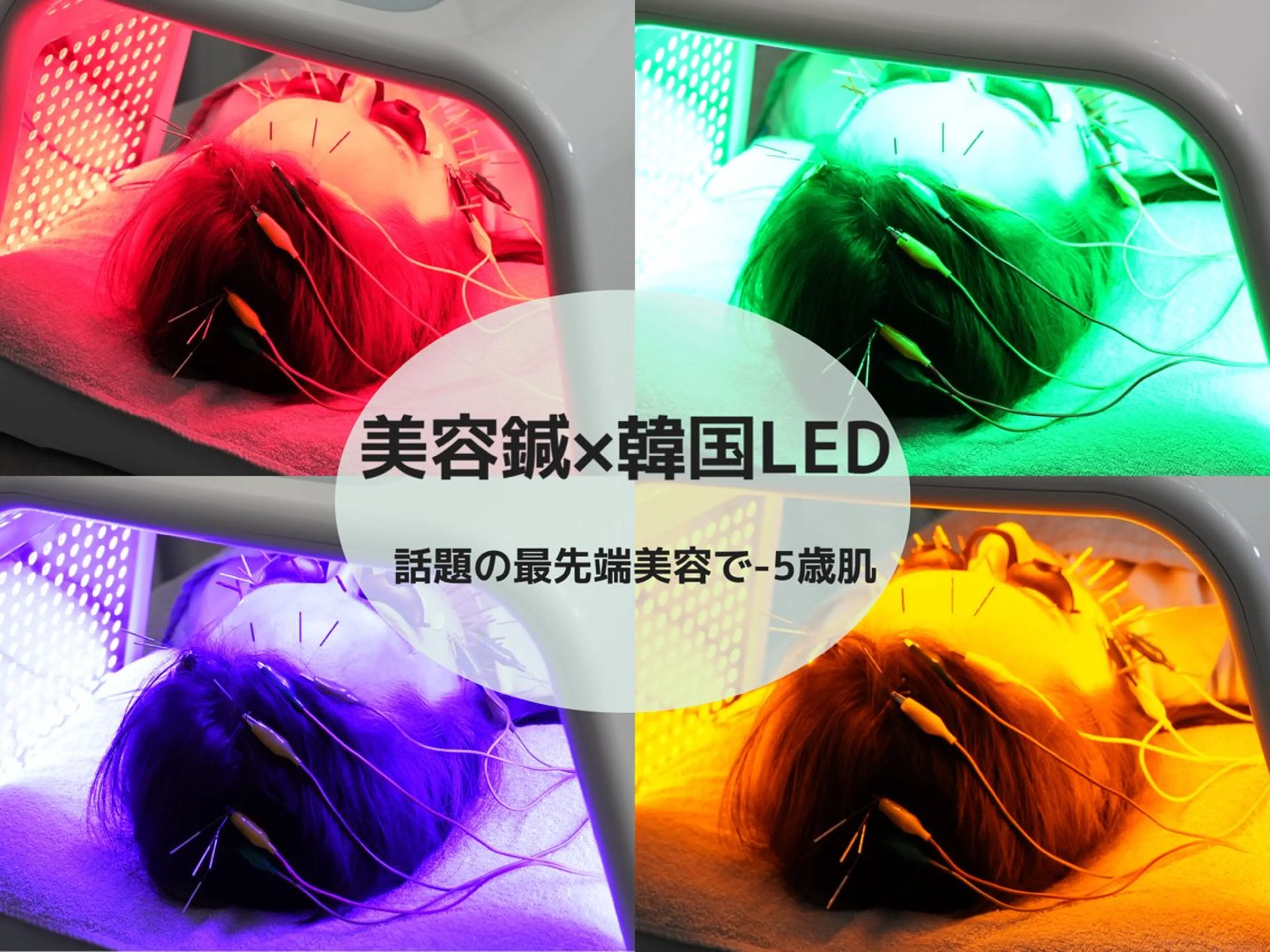【最先端美容】韓国LED×EMS美容鍼の写真