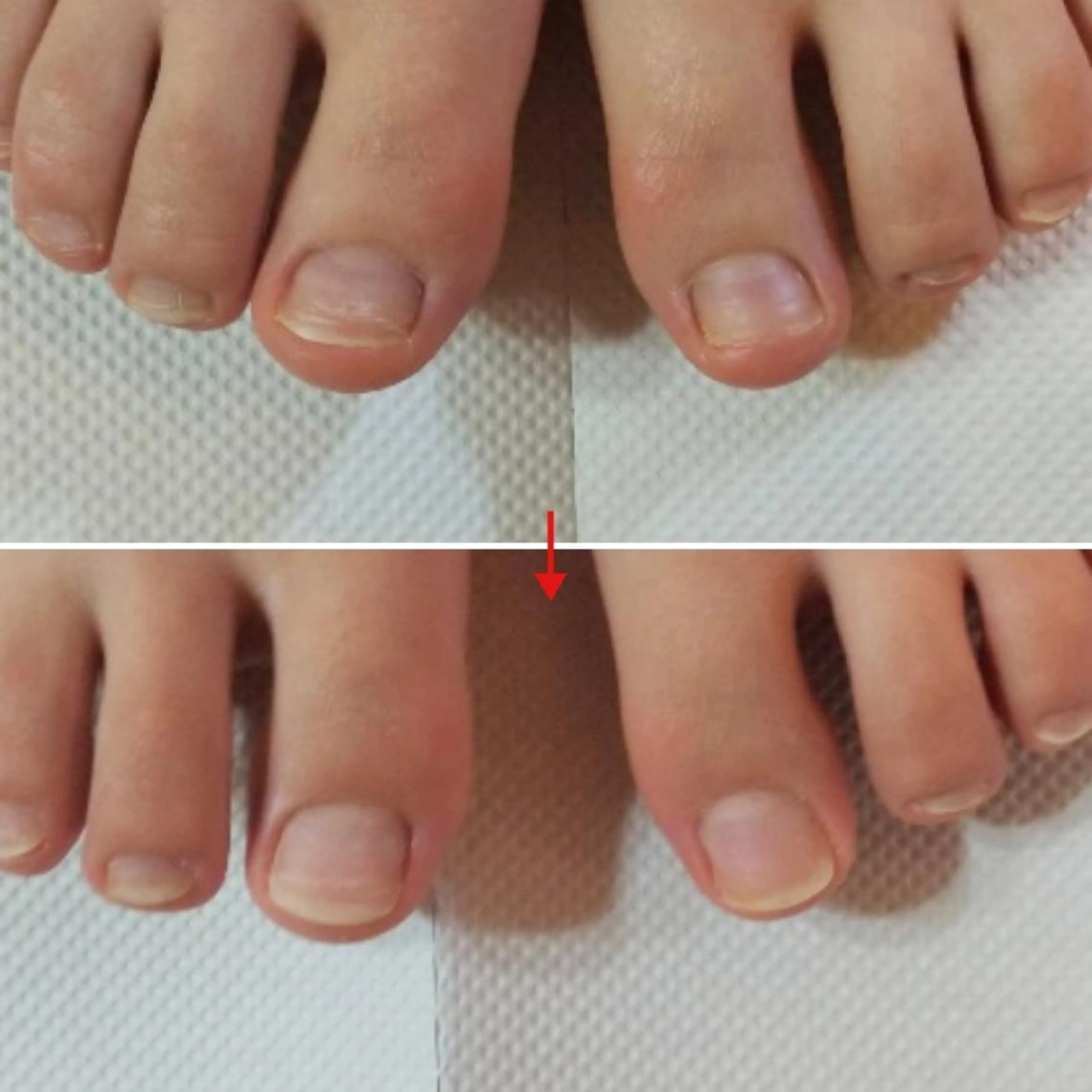 ネイル フットネイル ネイルサロンアリューム所属・ネイルサロン アリュームのネイルデザイン