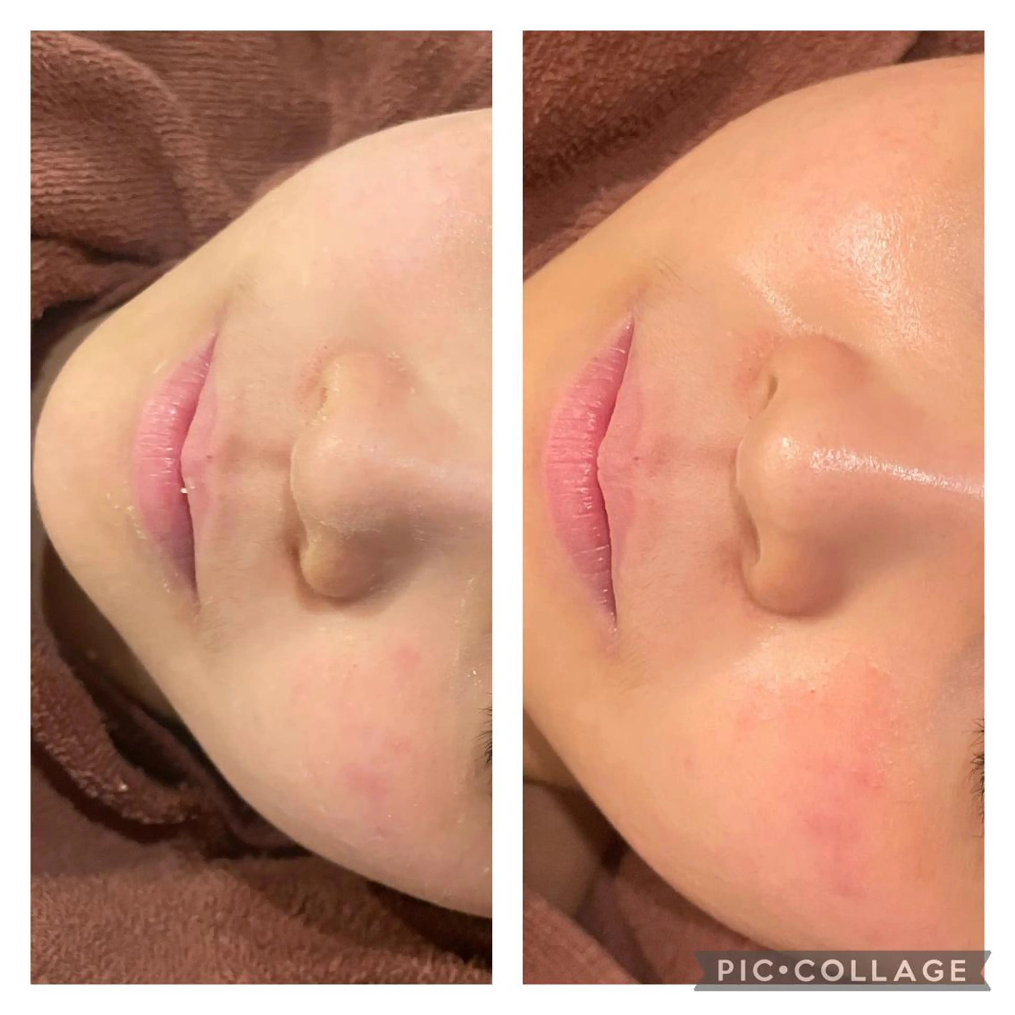 セミロング カラー パーマ ヘアアレンジ メンズ キッズ ネイル マツエク・マツパ アイブロウ エステ リラク ニキビ特化型エステ 🍓最短で肌質改善のエステ・リラクイメージ