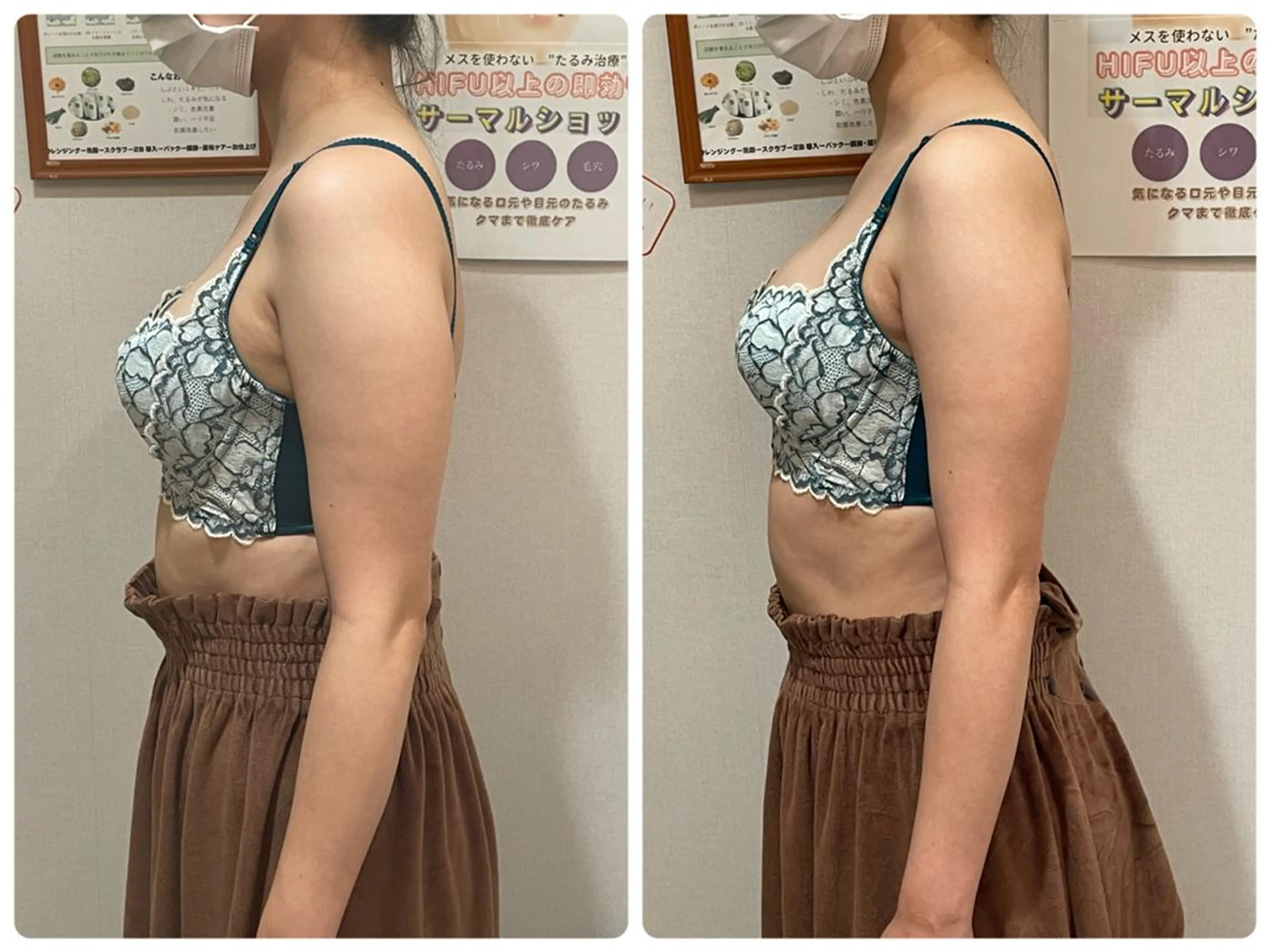 創業40周年✨美肌サ ロンRAYVIS銀座のエステ・リラクイメージ