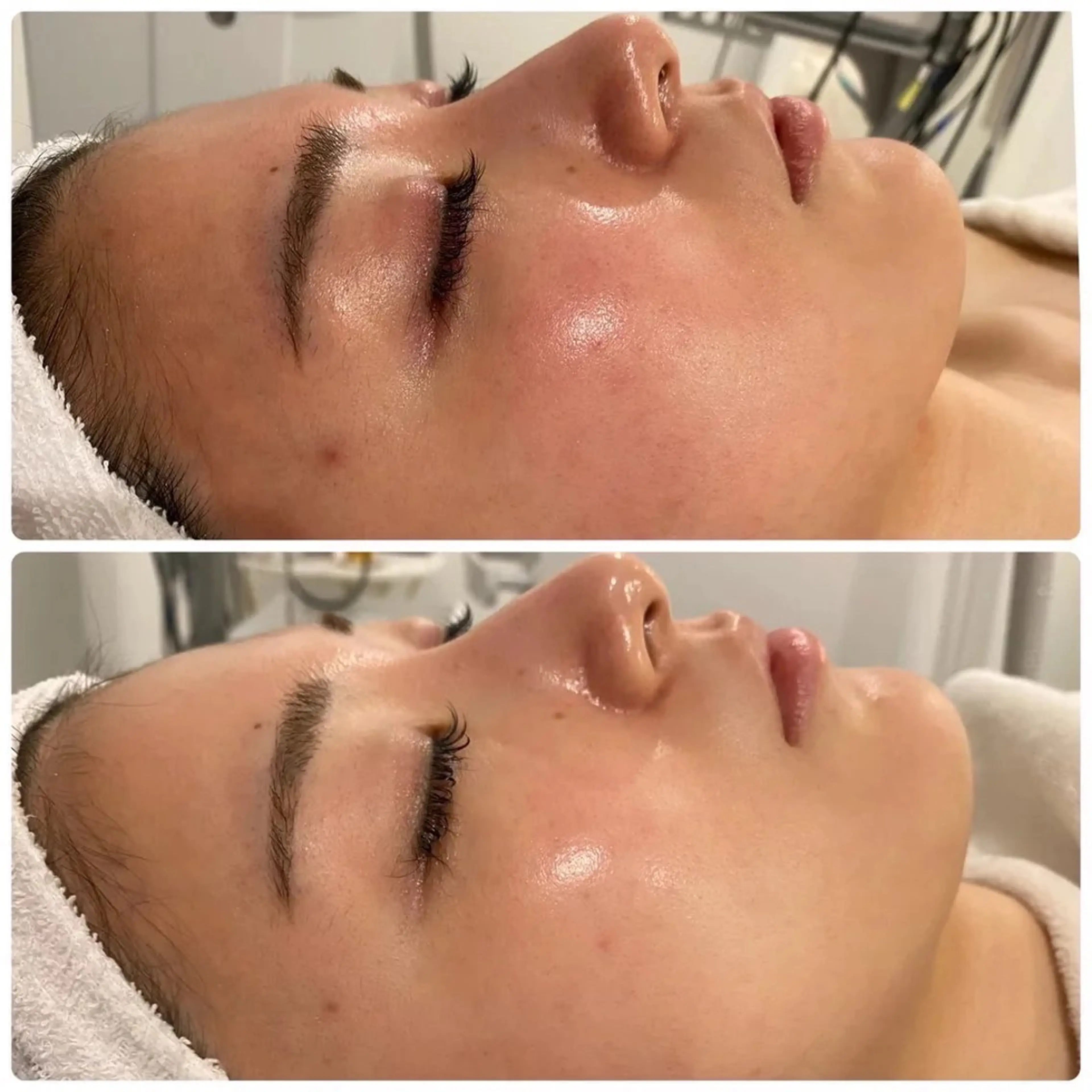 ✨️美肌フォト✨️顔全体🌺の写真