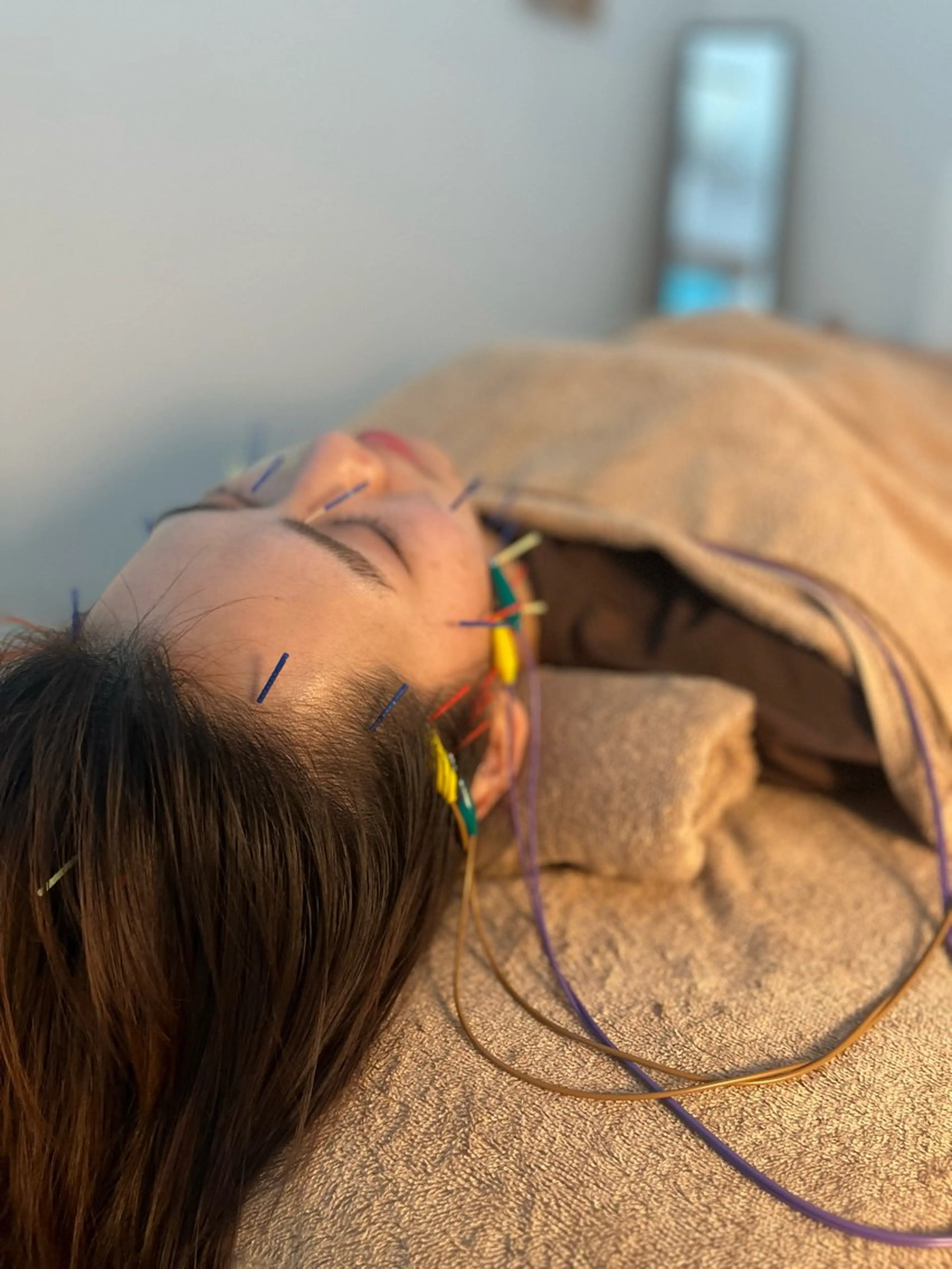 エステ リラク 整体×美容鍼灸 鍼灸師Miyanoのエステ・リラクイメージ