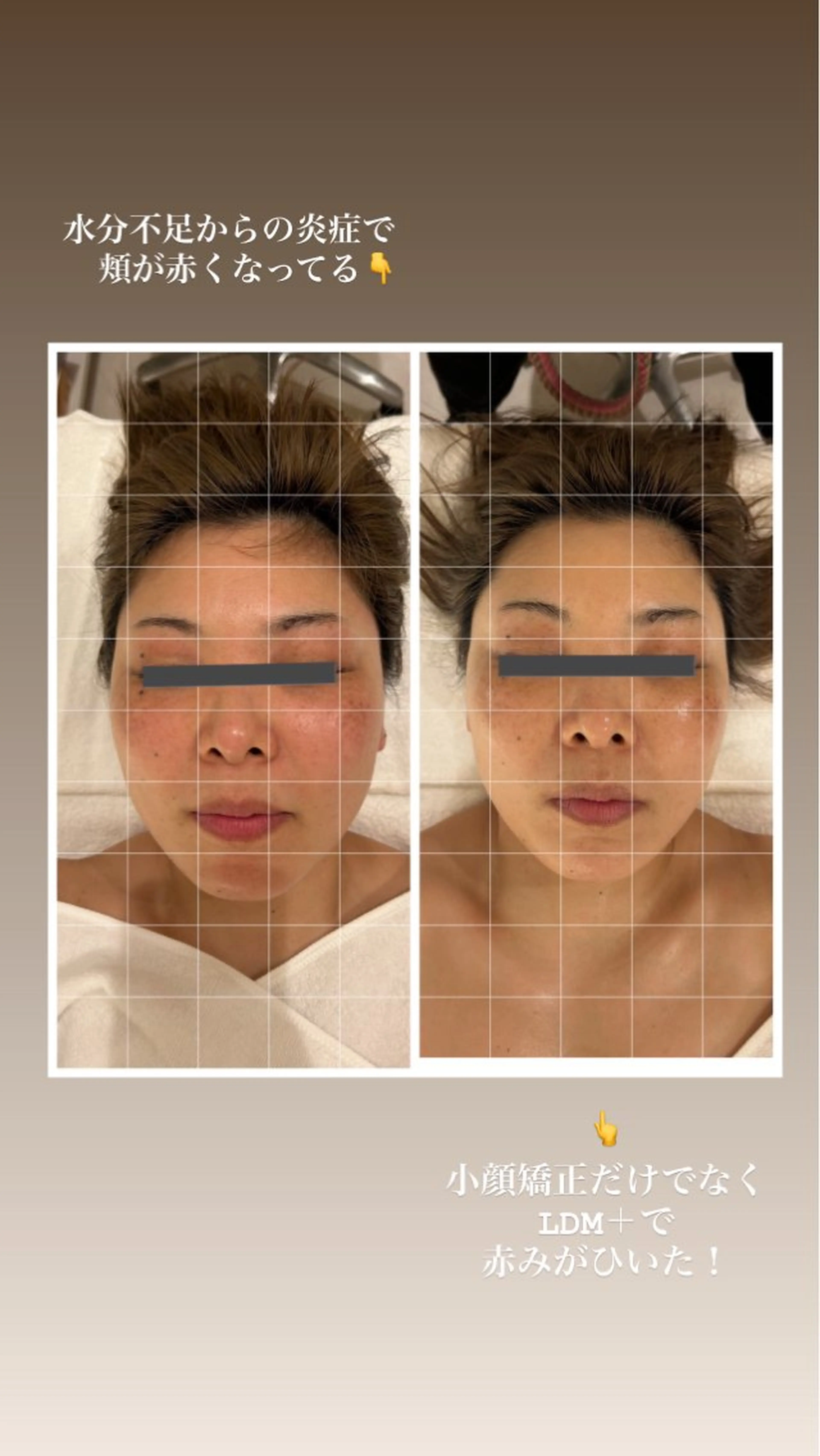 エステ リラク mine.mマインエム所属・mine.mi マインエムのエステ・リラクイメージ