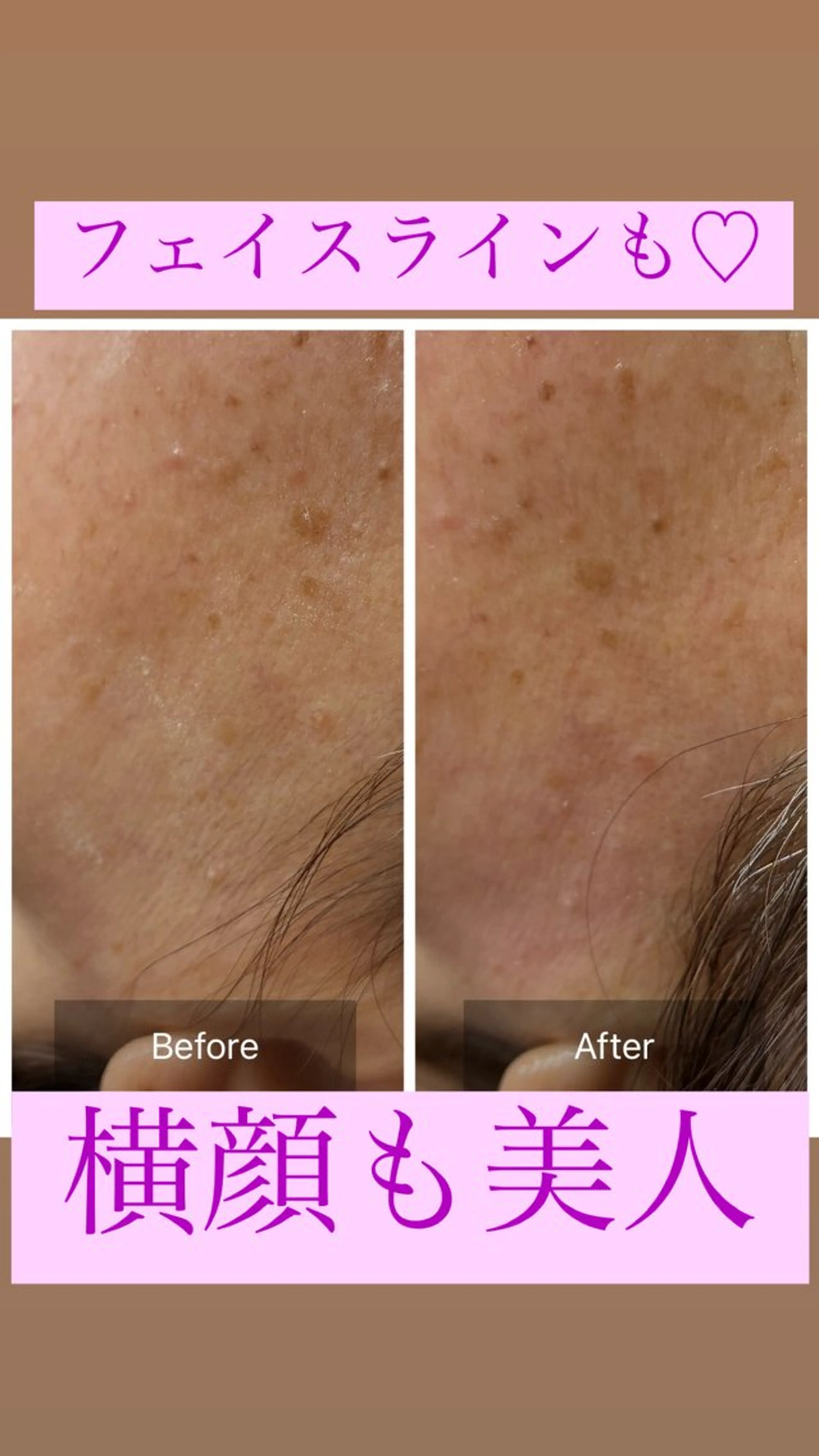 脱毛 産毛専門店 Bittoのエステ・リラクイメージ