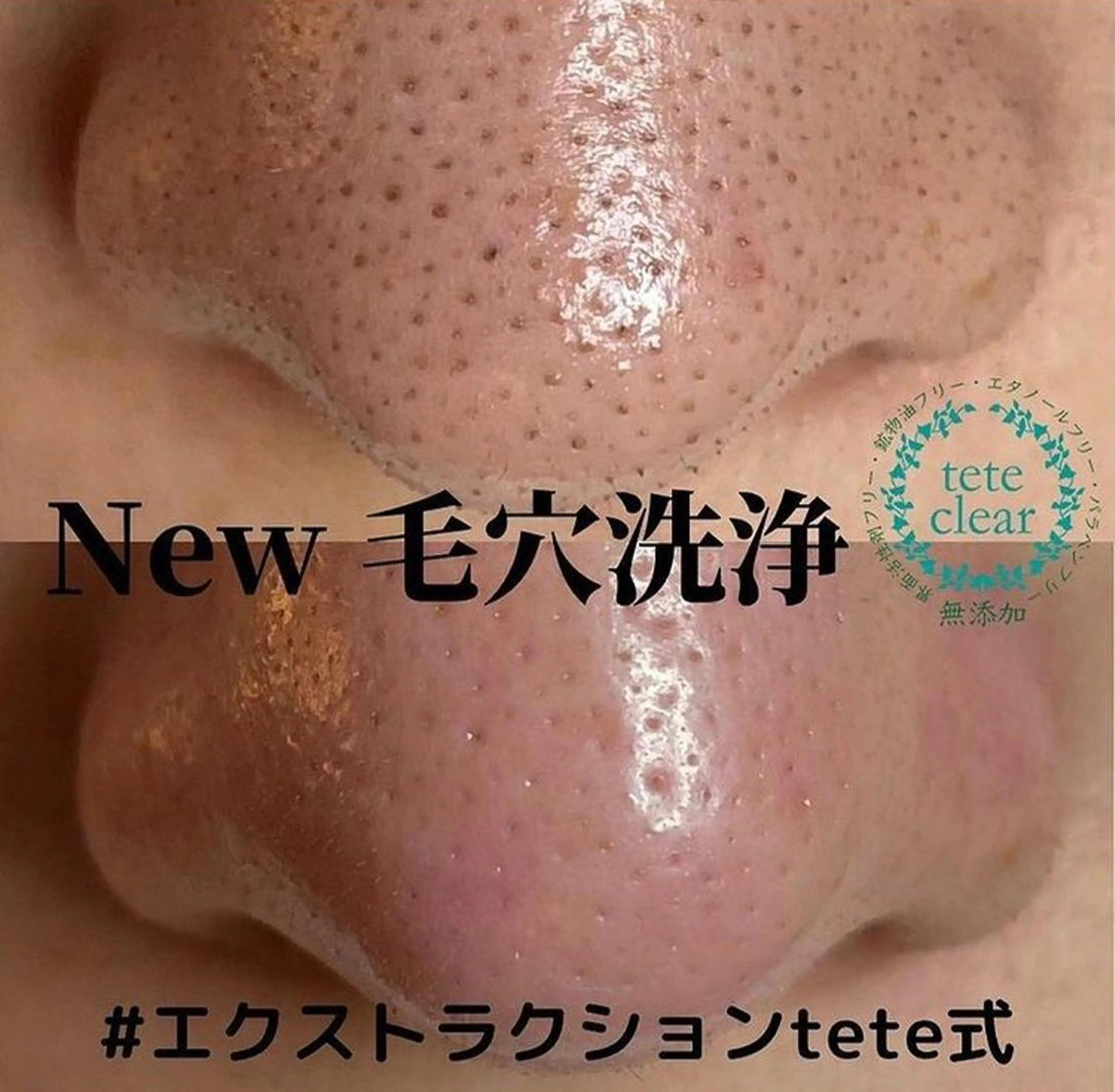 【しみ毛穴専門店】beautysalon Ankh所属・しみ毛穴専門店 Ankh 平田のエステ・リラクイメージ