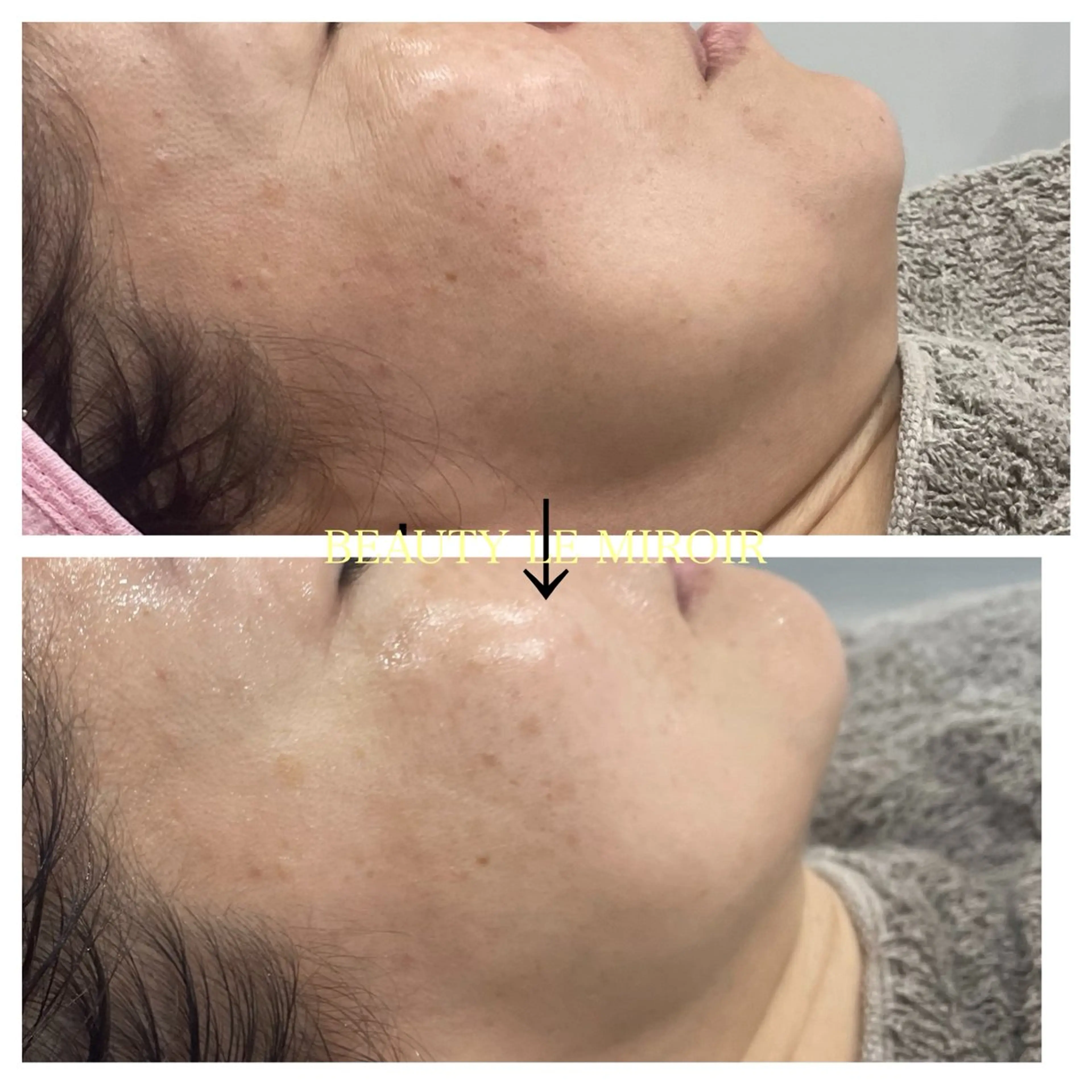 エステ ビューティー ミロワールのエステ・リラクイメージ