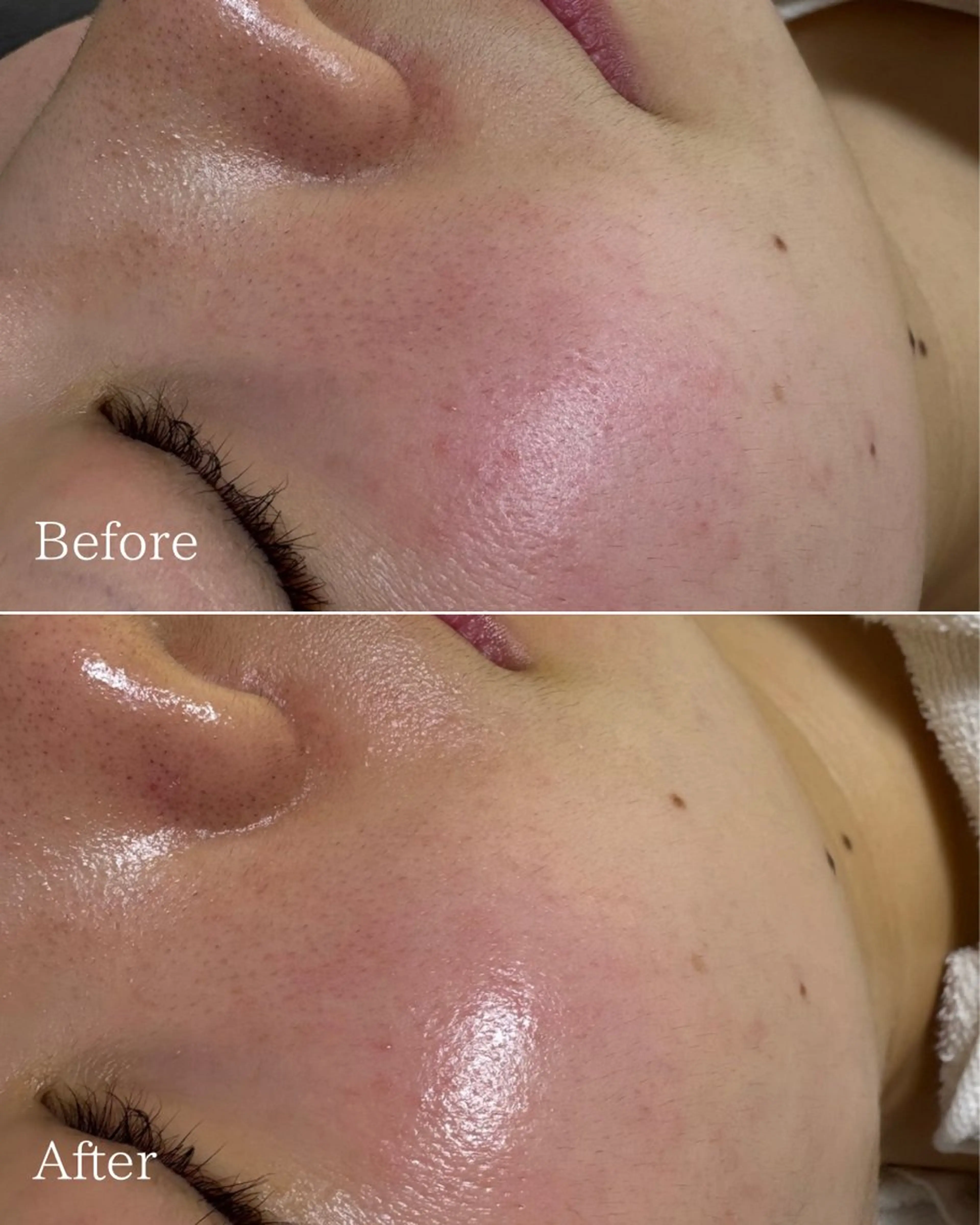 高保湿シワ改善マスク【ヘッドスパショートコース付き！】の写真