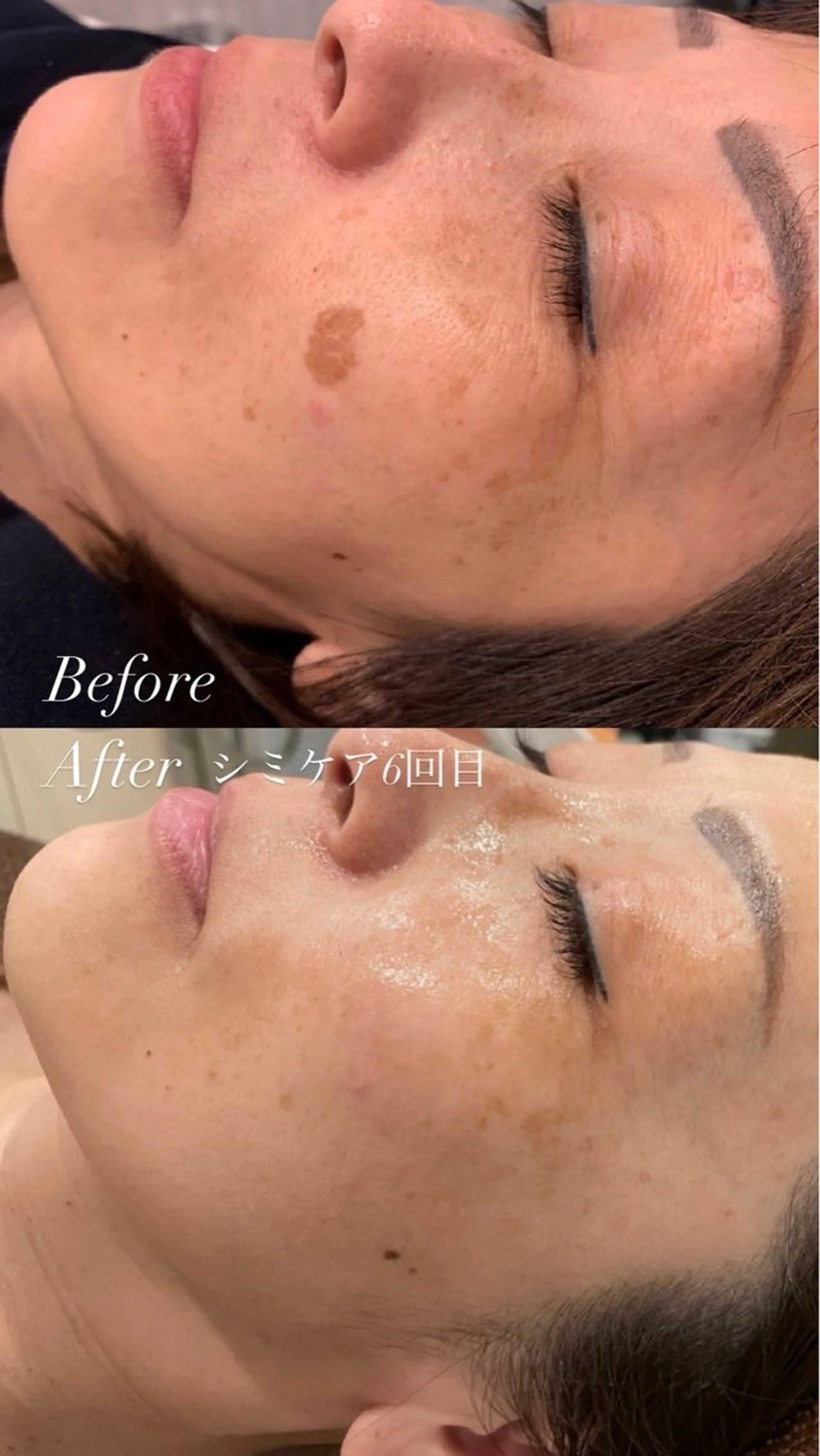 エステ # fu♡のエステ・リラクイメージ