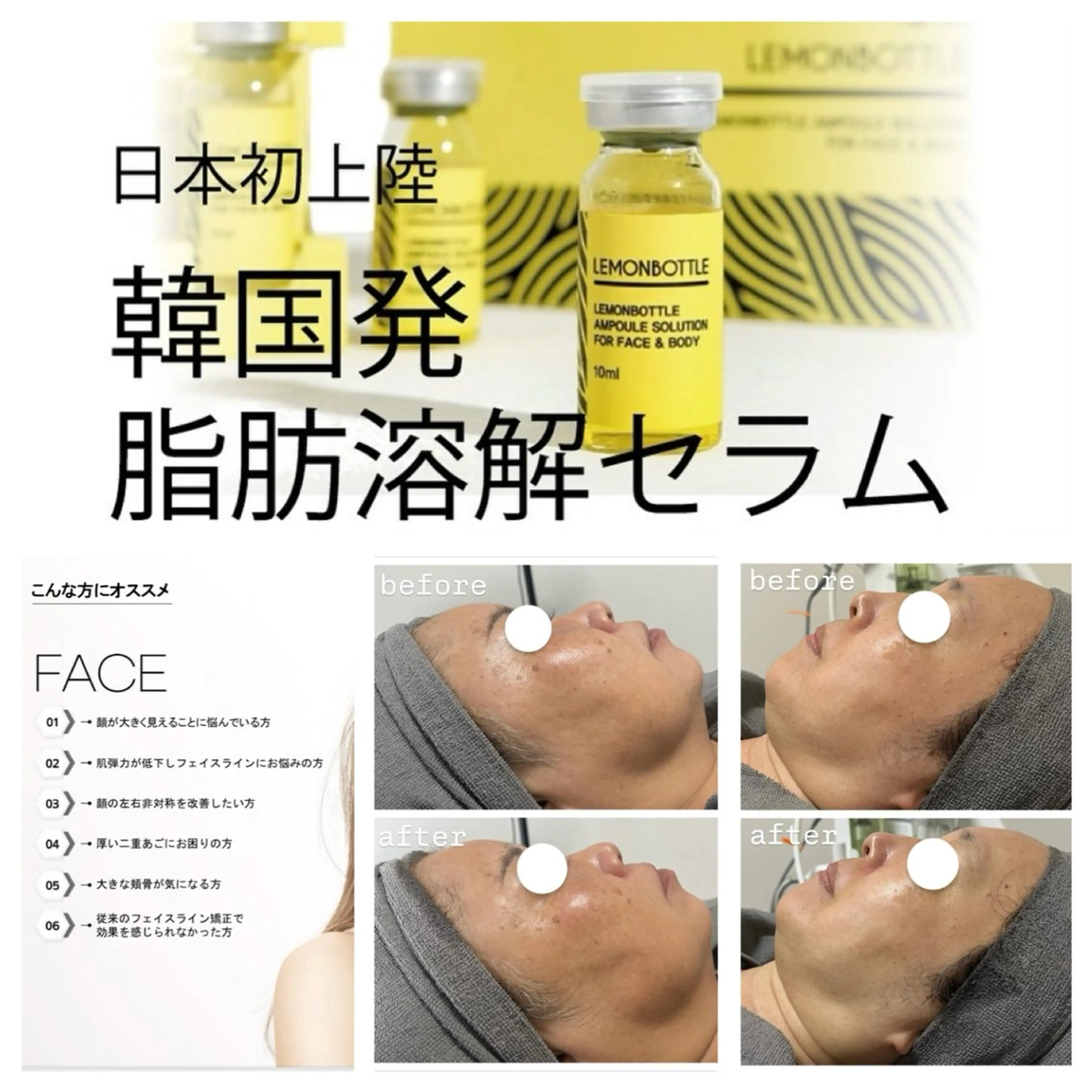 誕生日月の方限定スペシャルフェイシャル🫧の写真