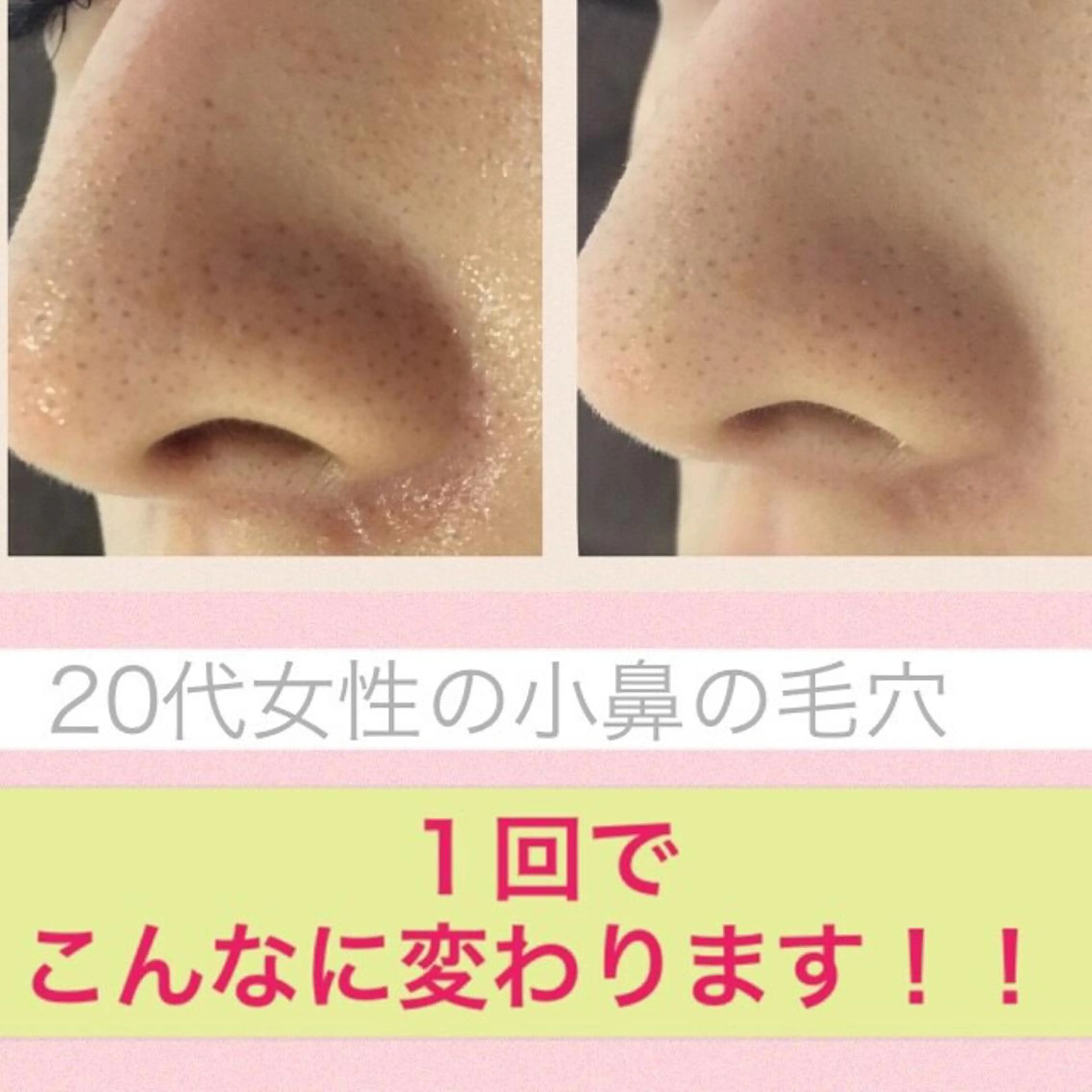 ミディアム カラー パーマ ヘアアレンジ メンズ キッズ ネイル マツエク・マツパ ニキビ・肌質改善専門 ♡人生が変わるサロンのエステ・リラクイメージ