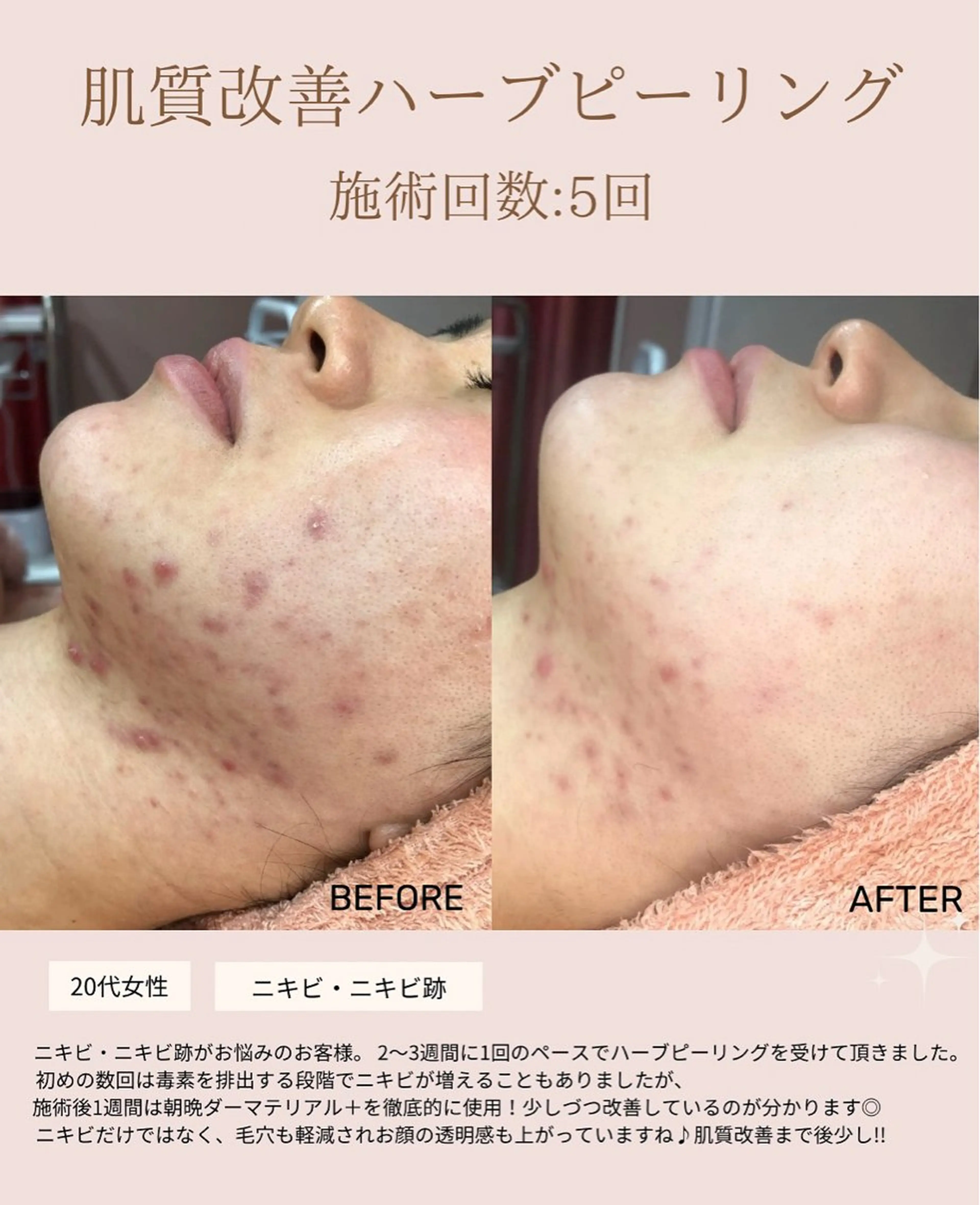 肌質改善専門サロン Bellmi/心斎橋のエステ・リラクイメージ