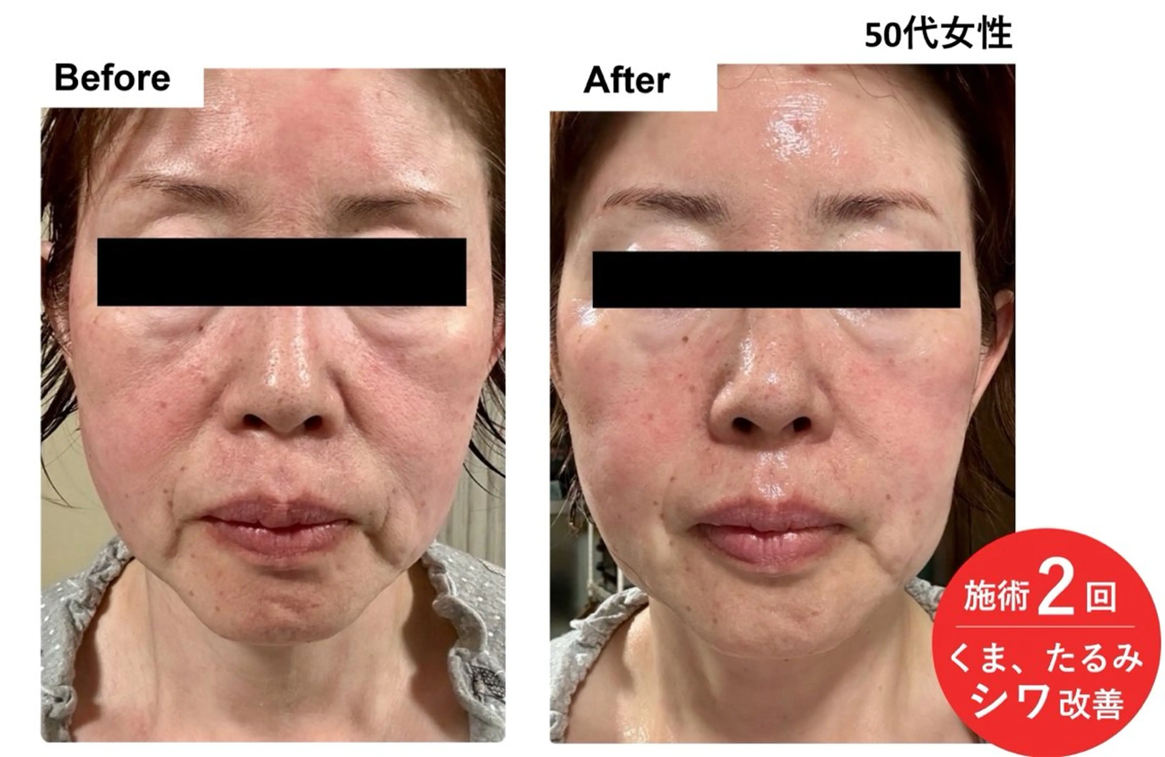 エステ シミ・若返り特化 さゆみのエステ・リラクイメージ