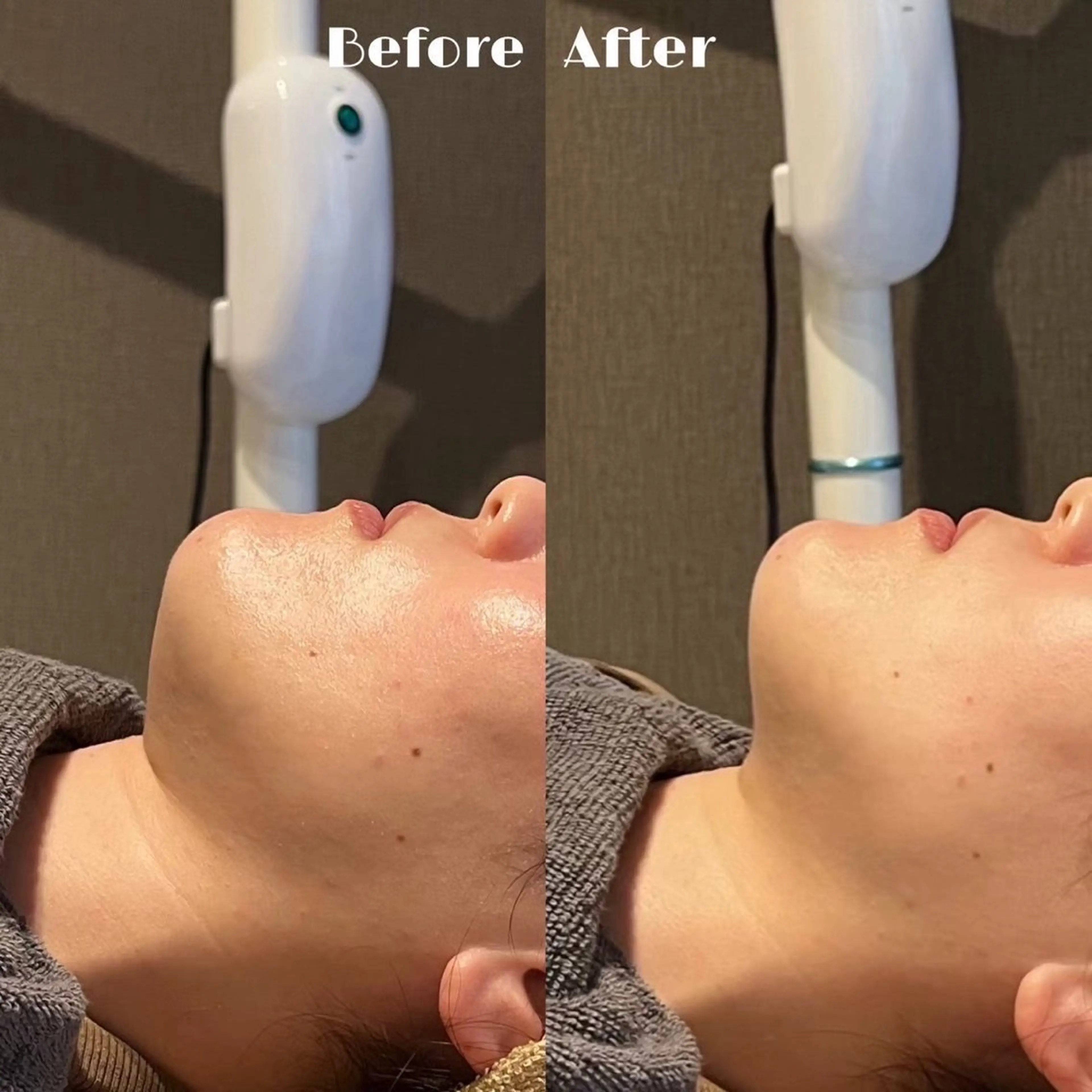 miyu 🩵のエステ・リラクイメージ