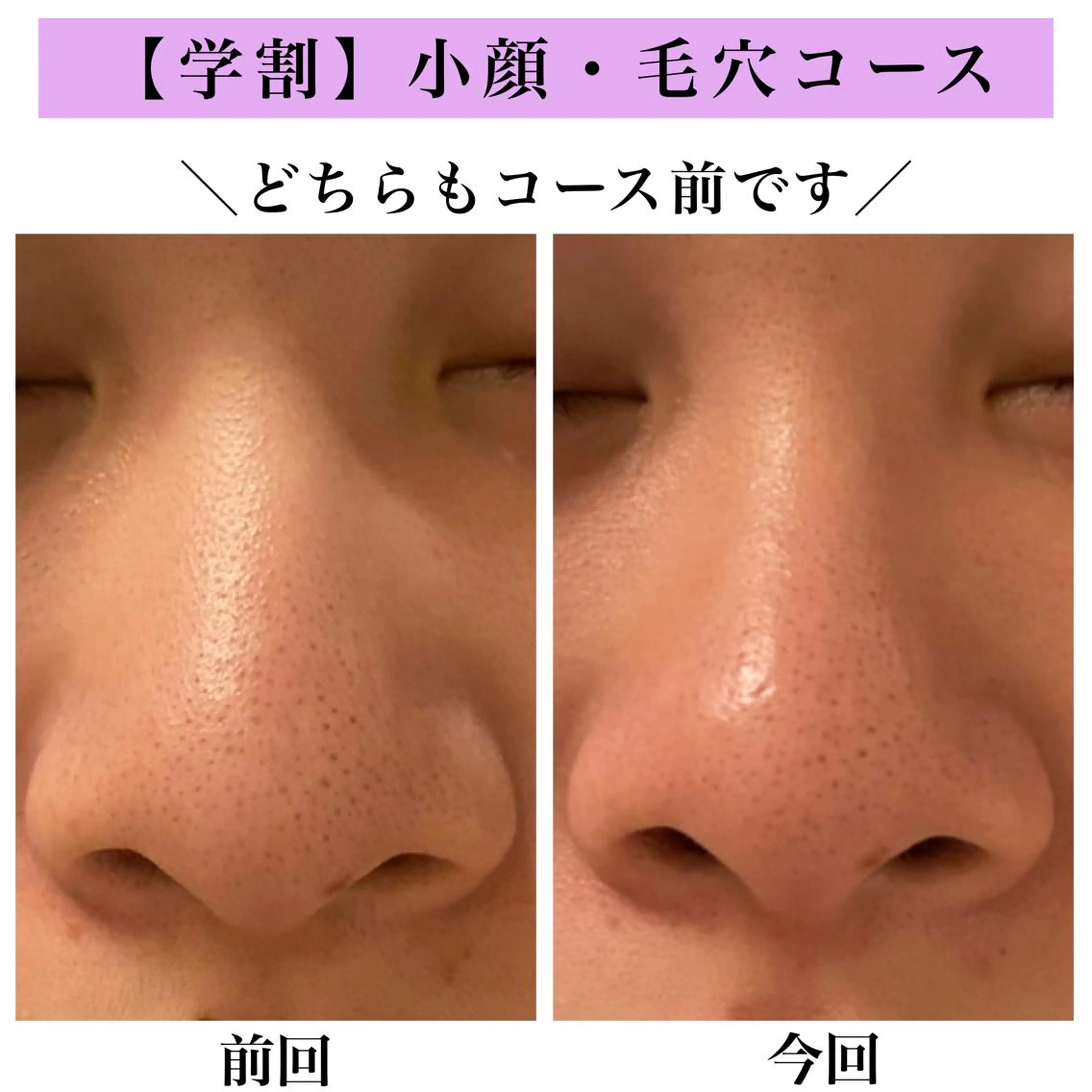 Bellesthe （ベルエステ）のエステ・リラクイメージ