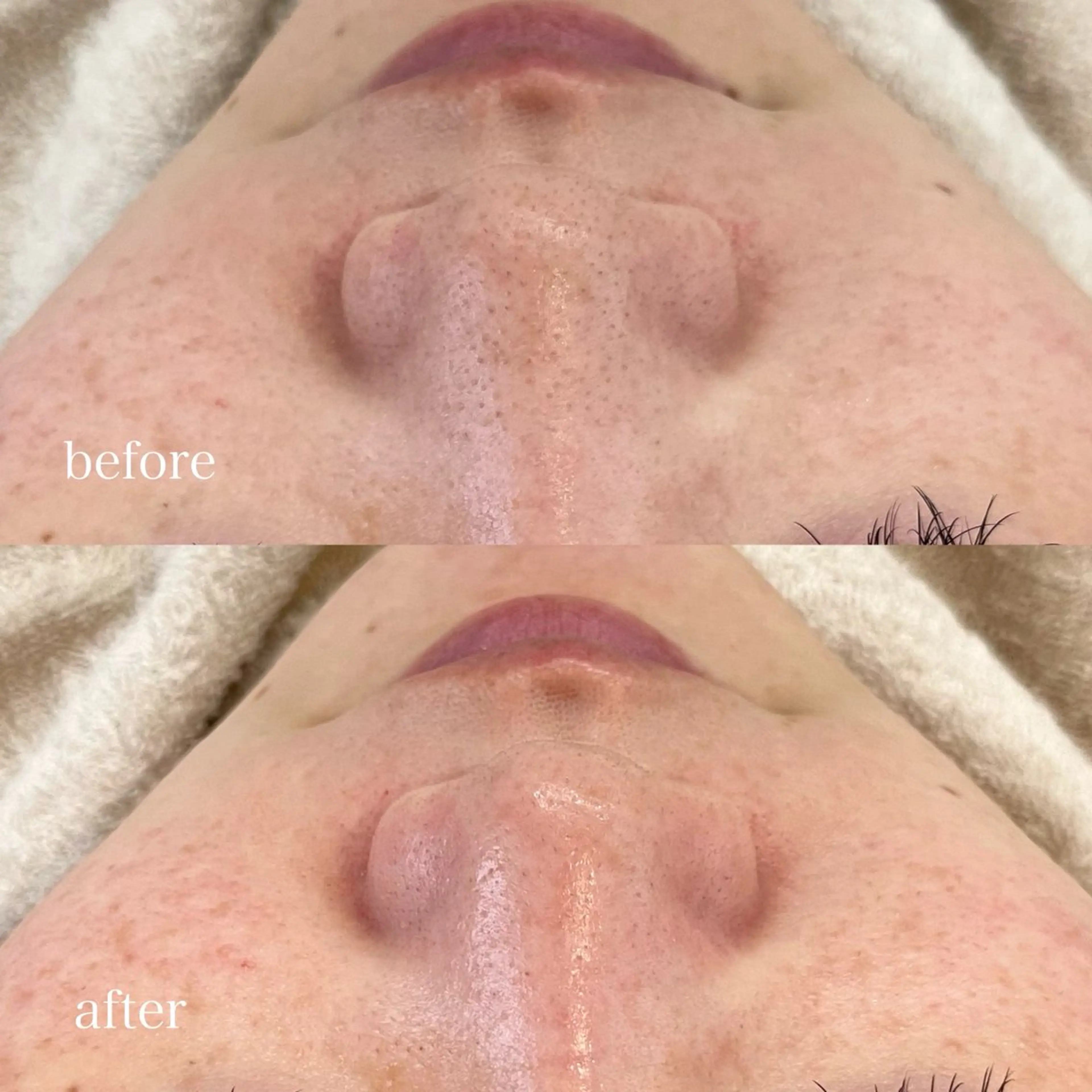 beautysalon RAVIS所属・東大阪/韓国肌管理/ 痩身バスト専門店のエステ・リラクイメージ