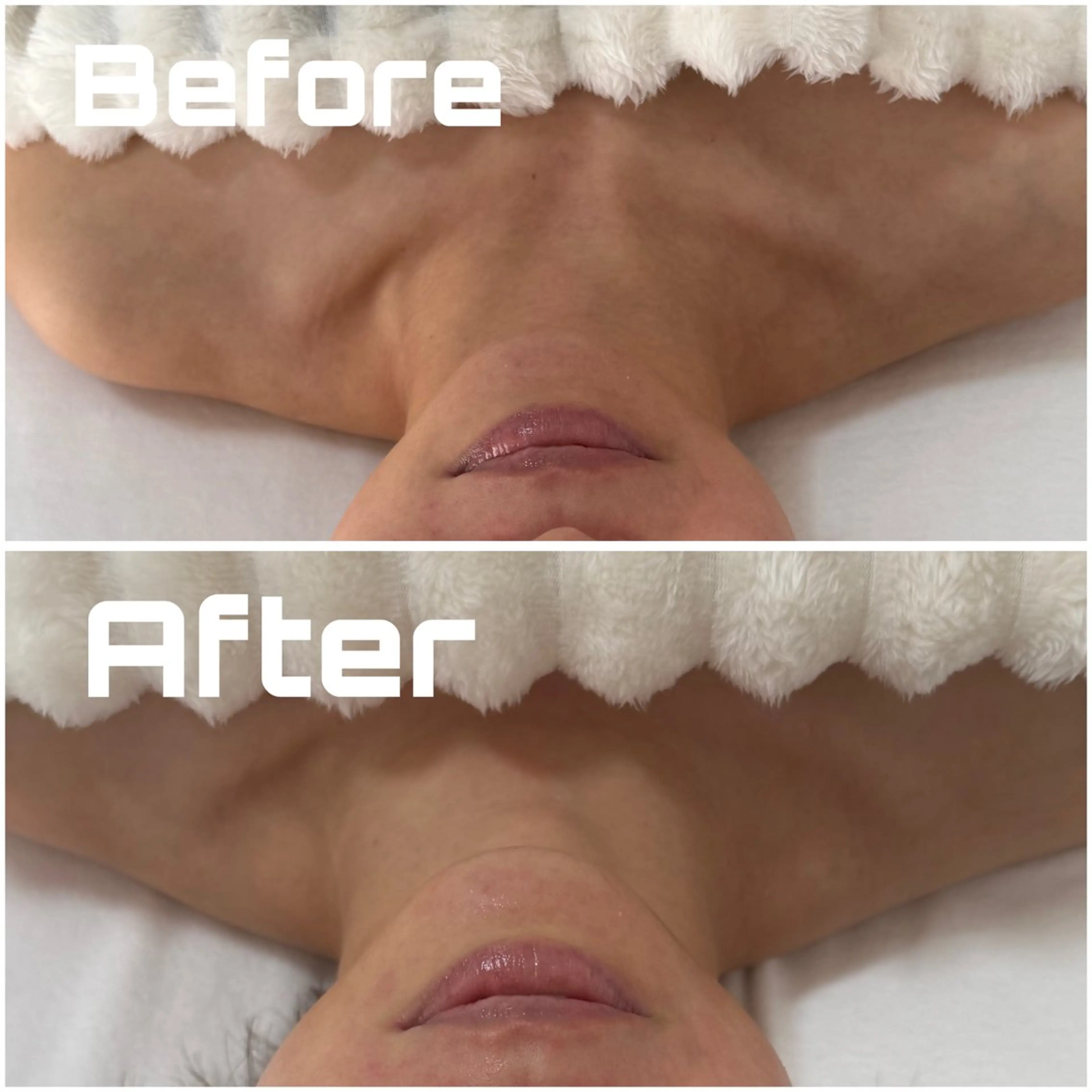 【上半身彫刻メソッド✨】デコルテを美しくデザイン🌿不要な重みを流し、スッキリとした理想のラインへの写真