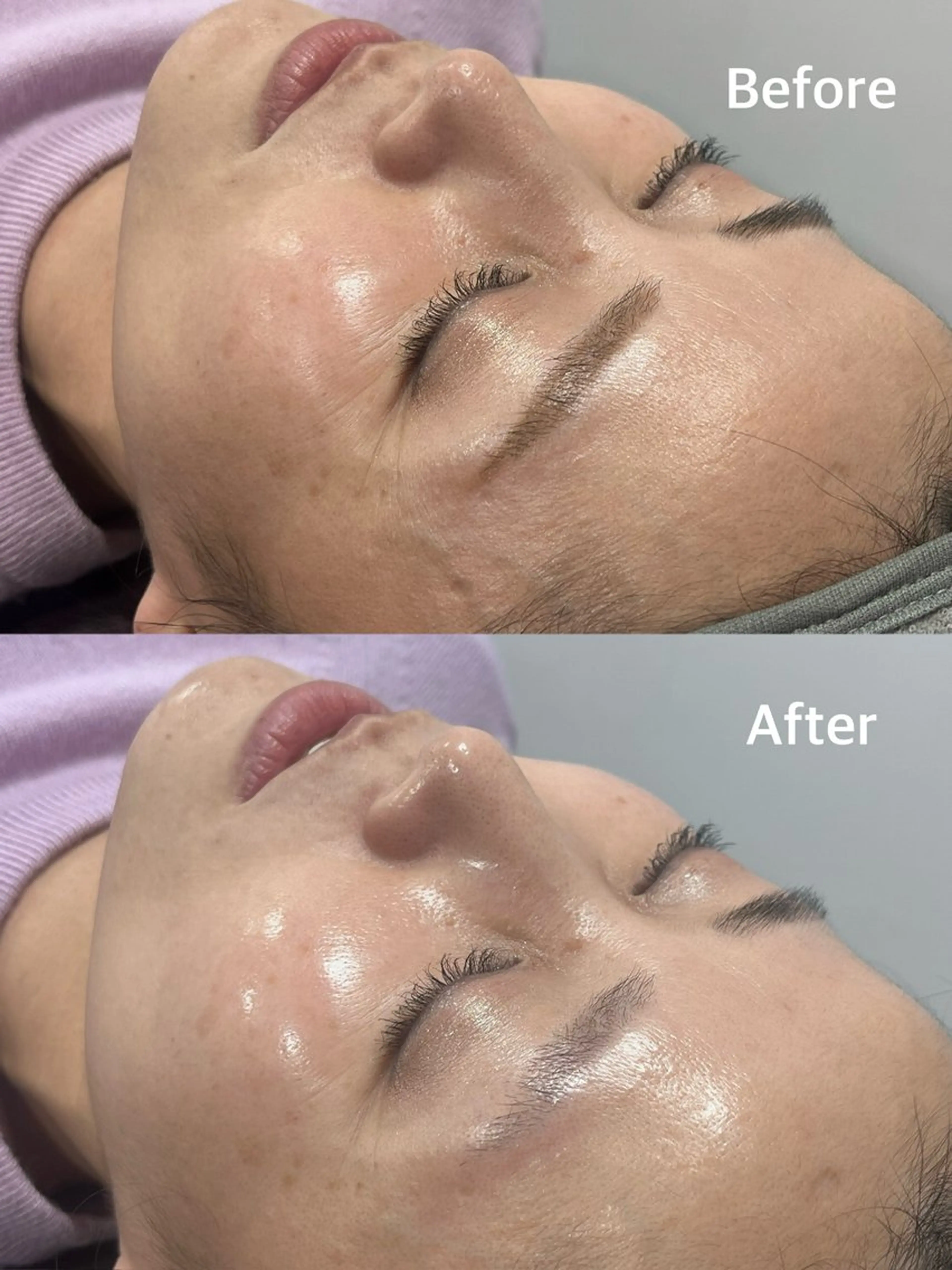 小顔専門看護師クリニカルサロンCOCO所属・小顔と美肌サロン クリニカルサロンココのエステ・リラクイメージ