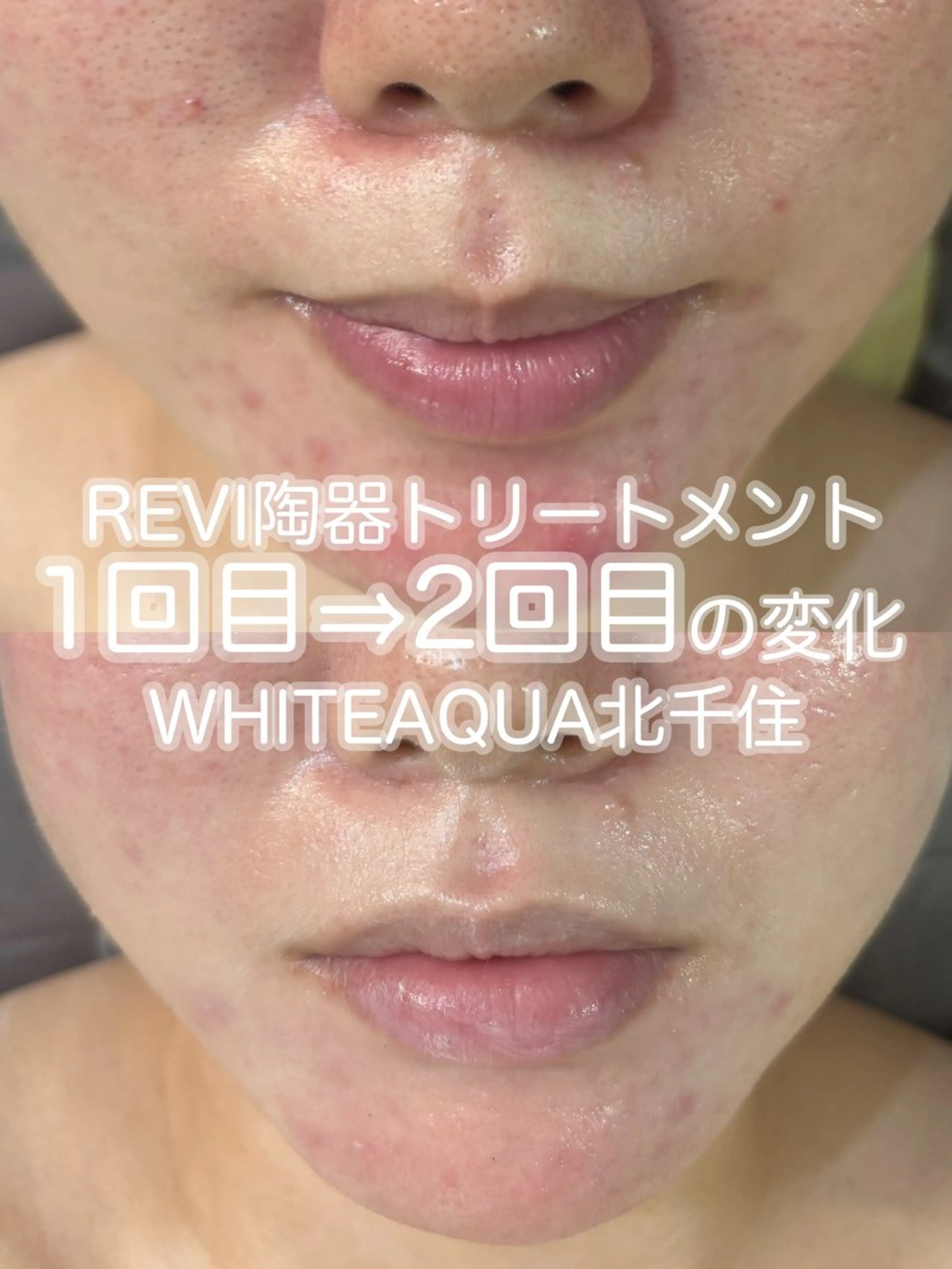 WHITE AQUA 北千住店のエステ・リラクイメージ