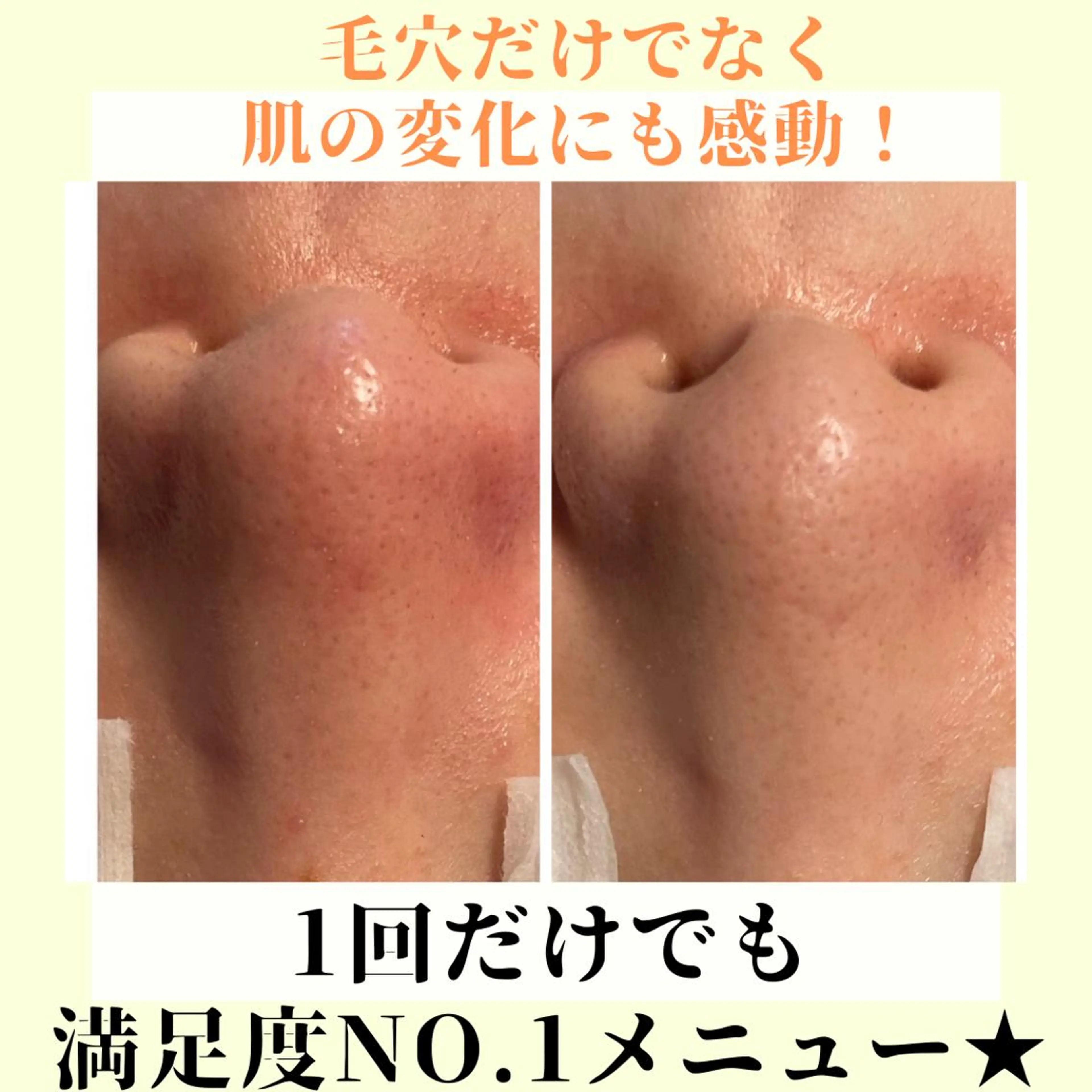 ピーリング専門店 Belluteのエステ・リラクイメージ