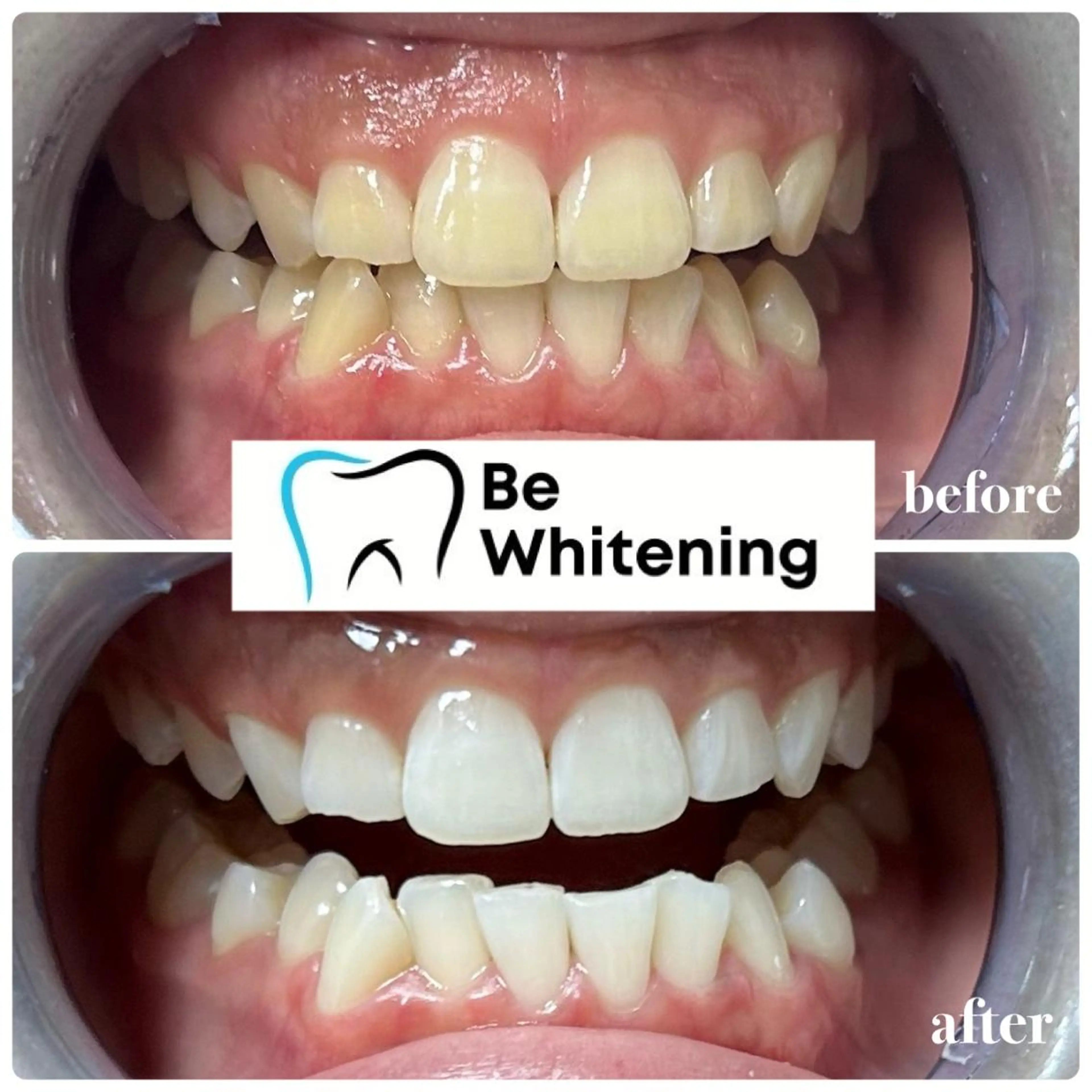 ホワイトニングサロン BE WHITE金山のその他イメージ