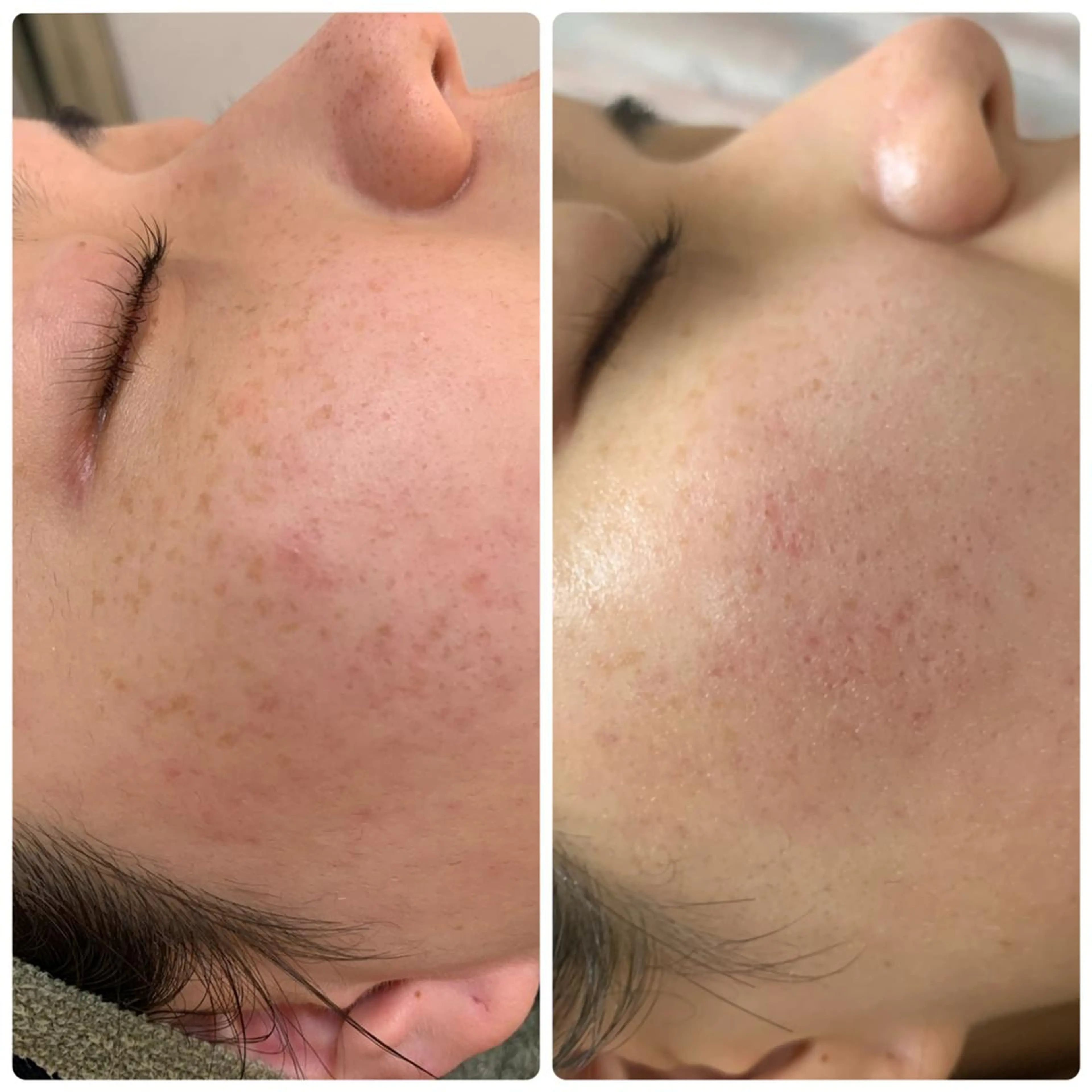 【ハーブピーリング&アロマリンパマッサージ nana】医療提携サロン所属・美肌&アロマ🌸 nana 中目黒のエステ・リラクイメージ