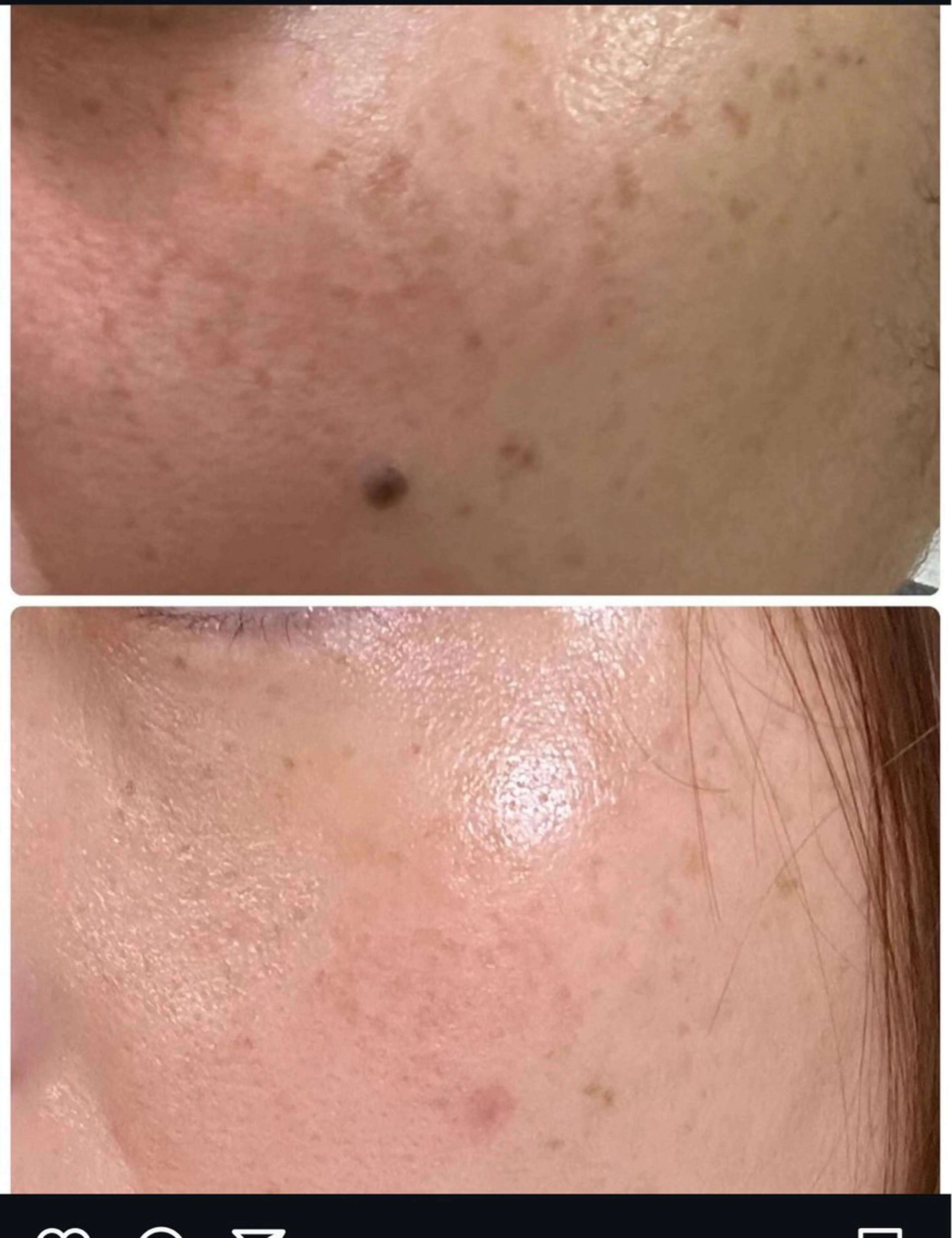 肌質改善🕊️ hirokoのエステ・リラクイメージ