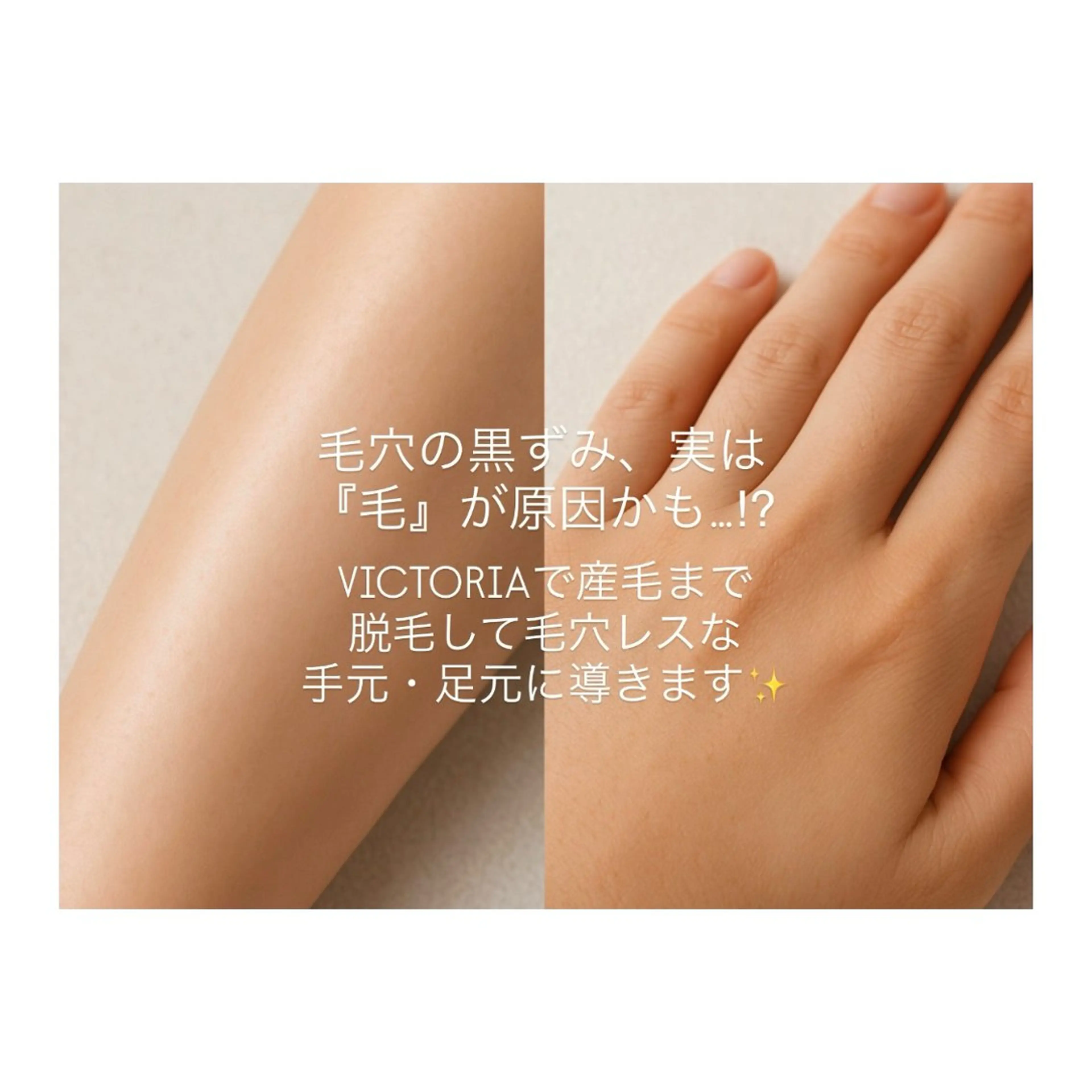 脱毛 M's Style NAIL BARのエステ・リラクイメージ