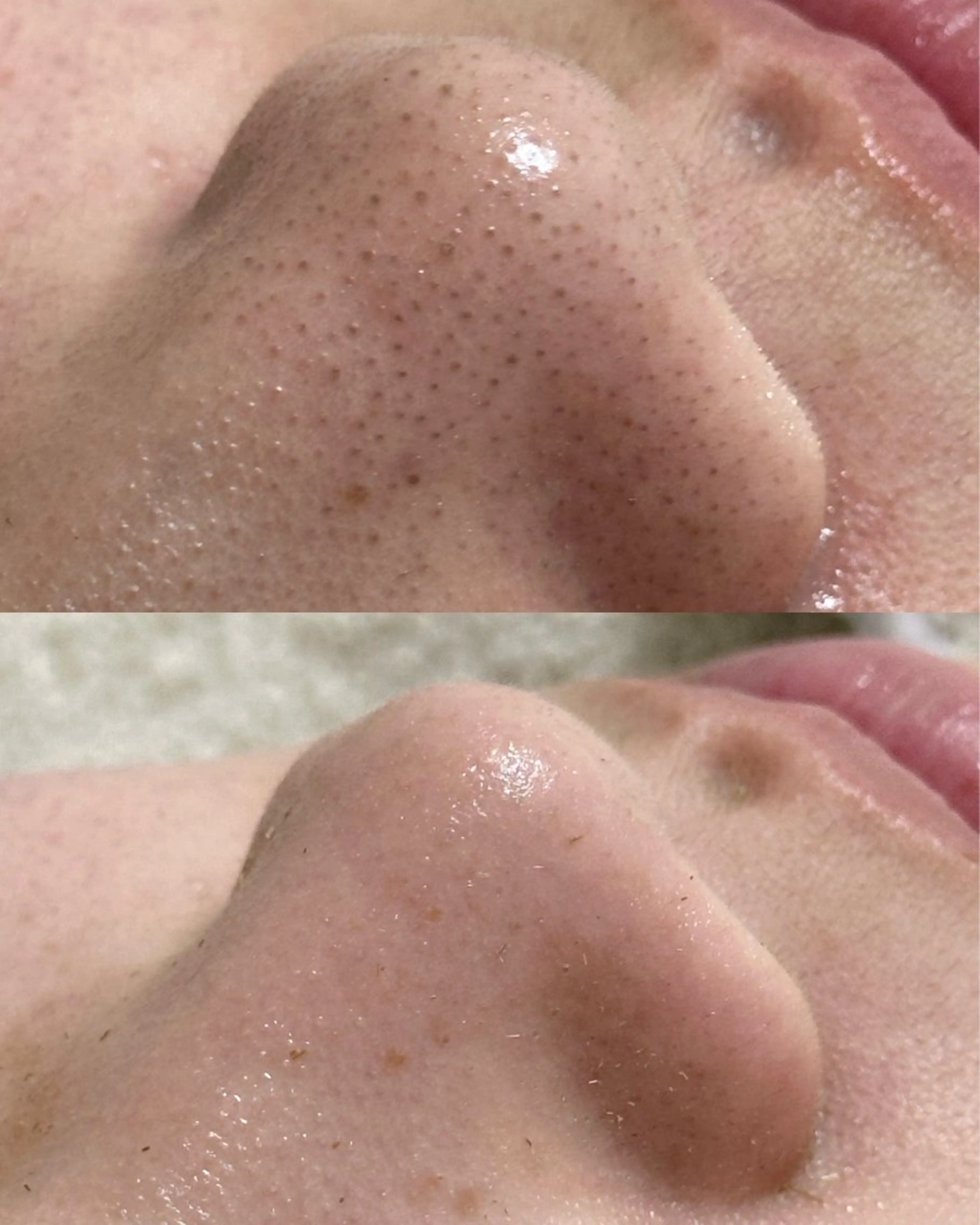 エステ Liber Kyoto所属・魔法の シミ取り職人のエステ・リラクイメージ