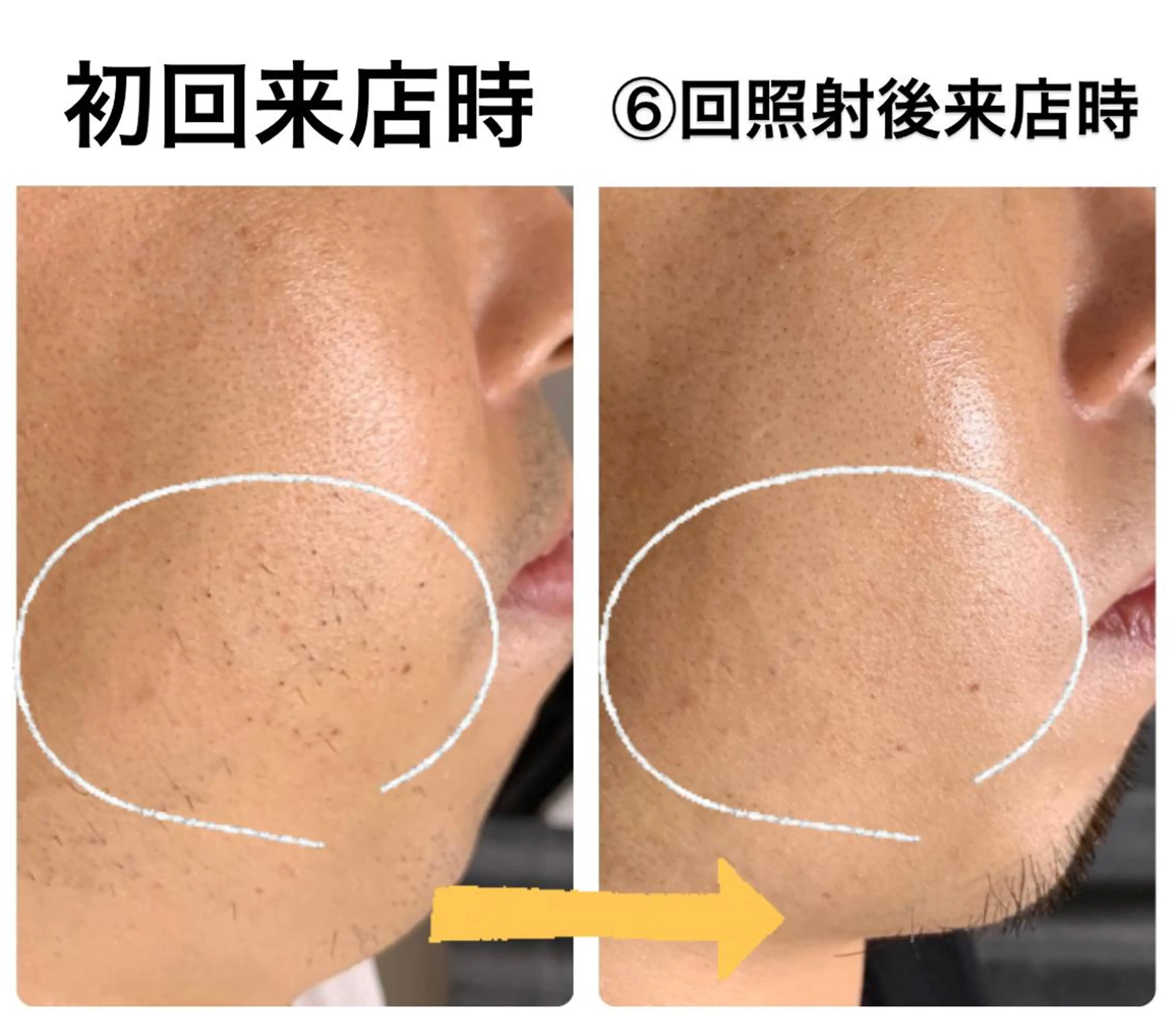 メンズ メンズハイライト メンズ脱毛サロン Le falcoのエステ・リラクイメージ