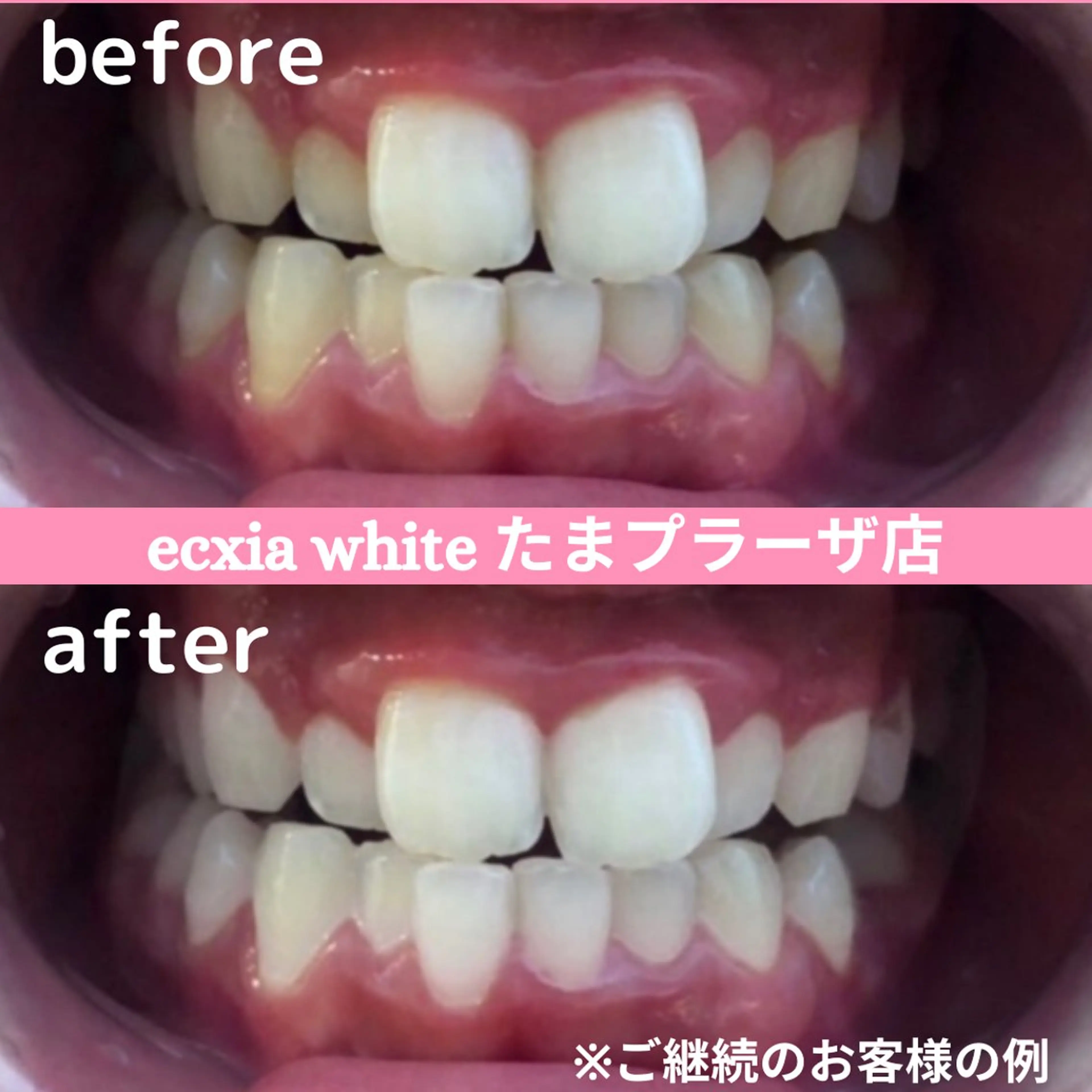 セルフホワイトニング エクシアたまプラーザ店所属・セルフホワイトニング エクシアたまプラーザのその他イメージ